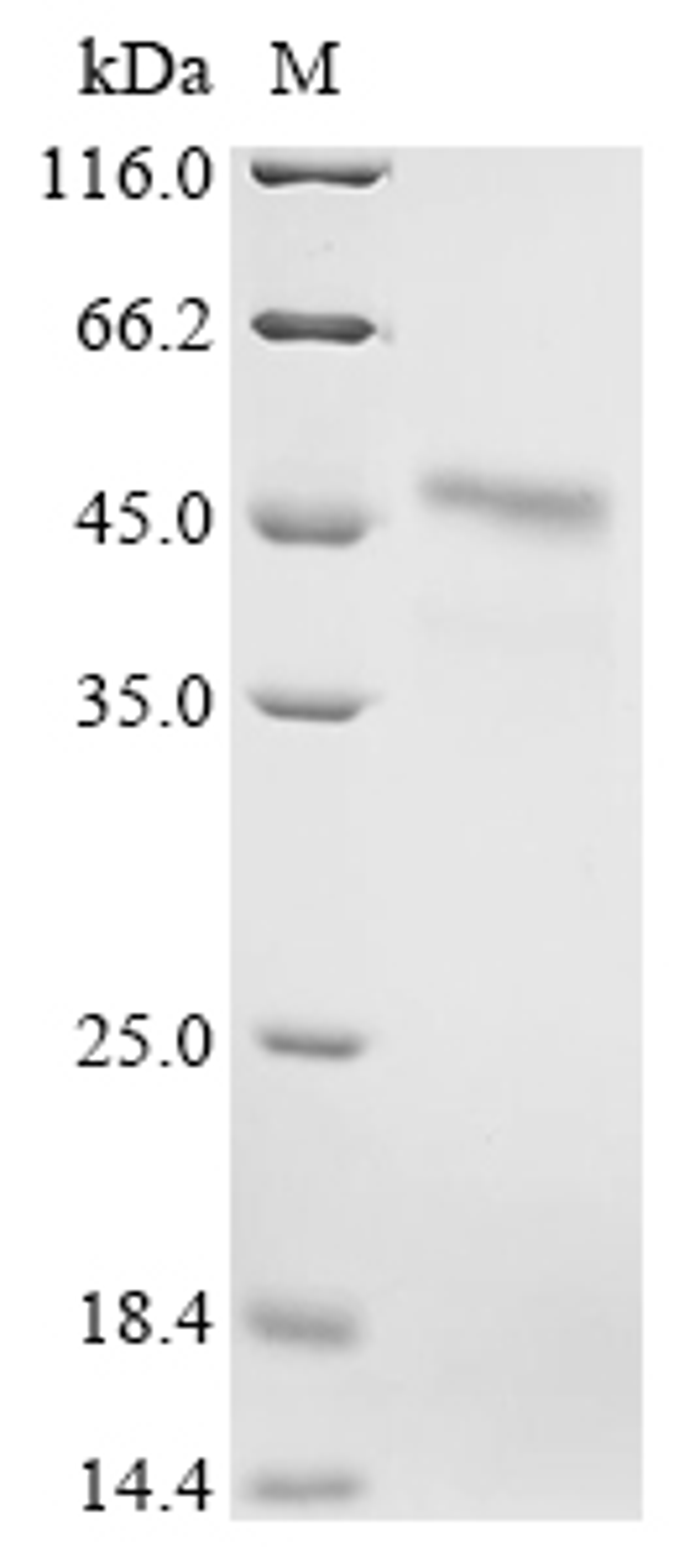 (Tris-Glycine gel) Discontinuous SDS-PAGE (reduced) with 5% enrichment gel and 15% separation gel.