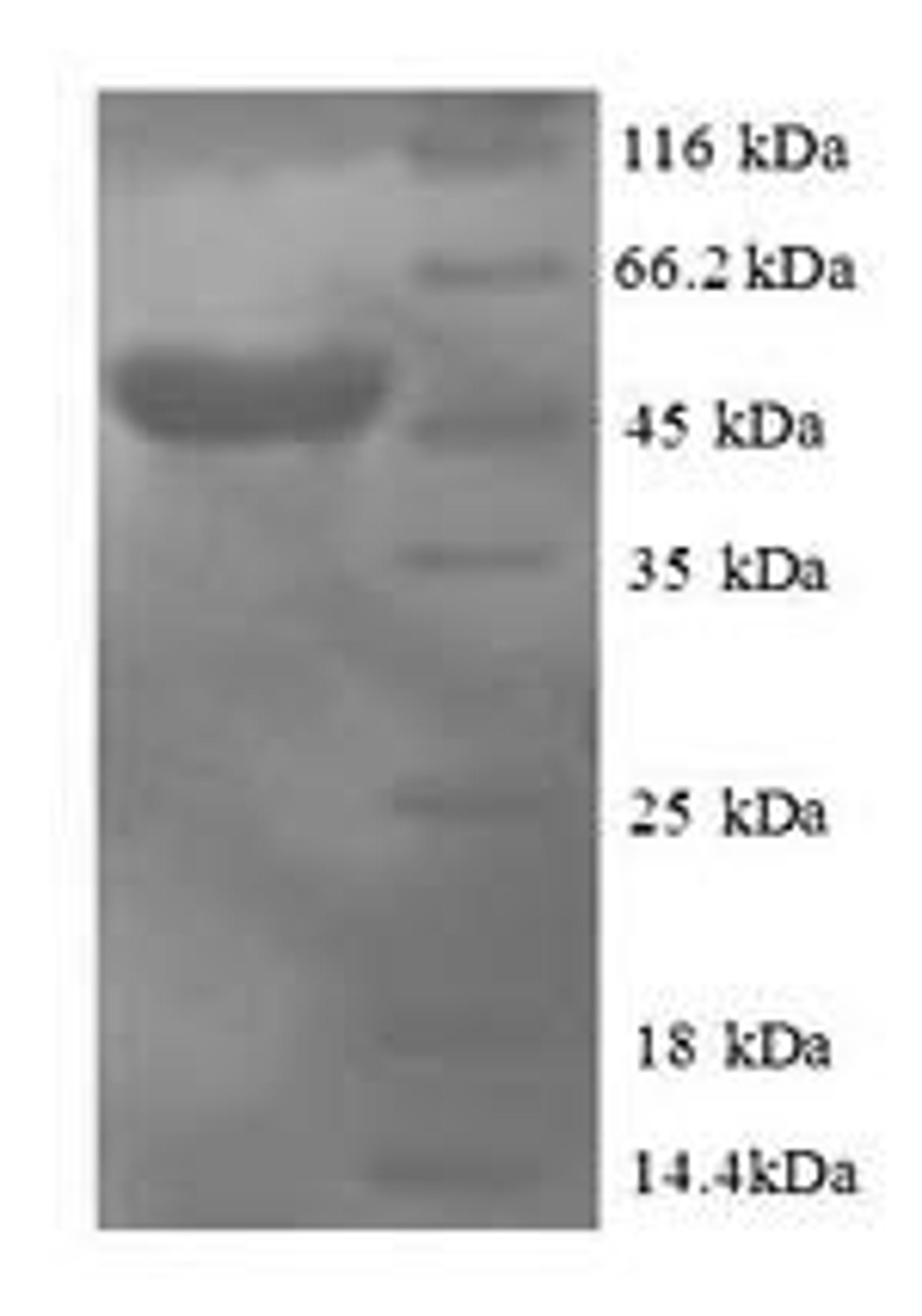 (Tris-Glycine gel) Discontinuous SDS-PAGE (reduced) with 5% enrichment gel and 15% separation gel.