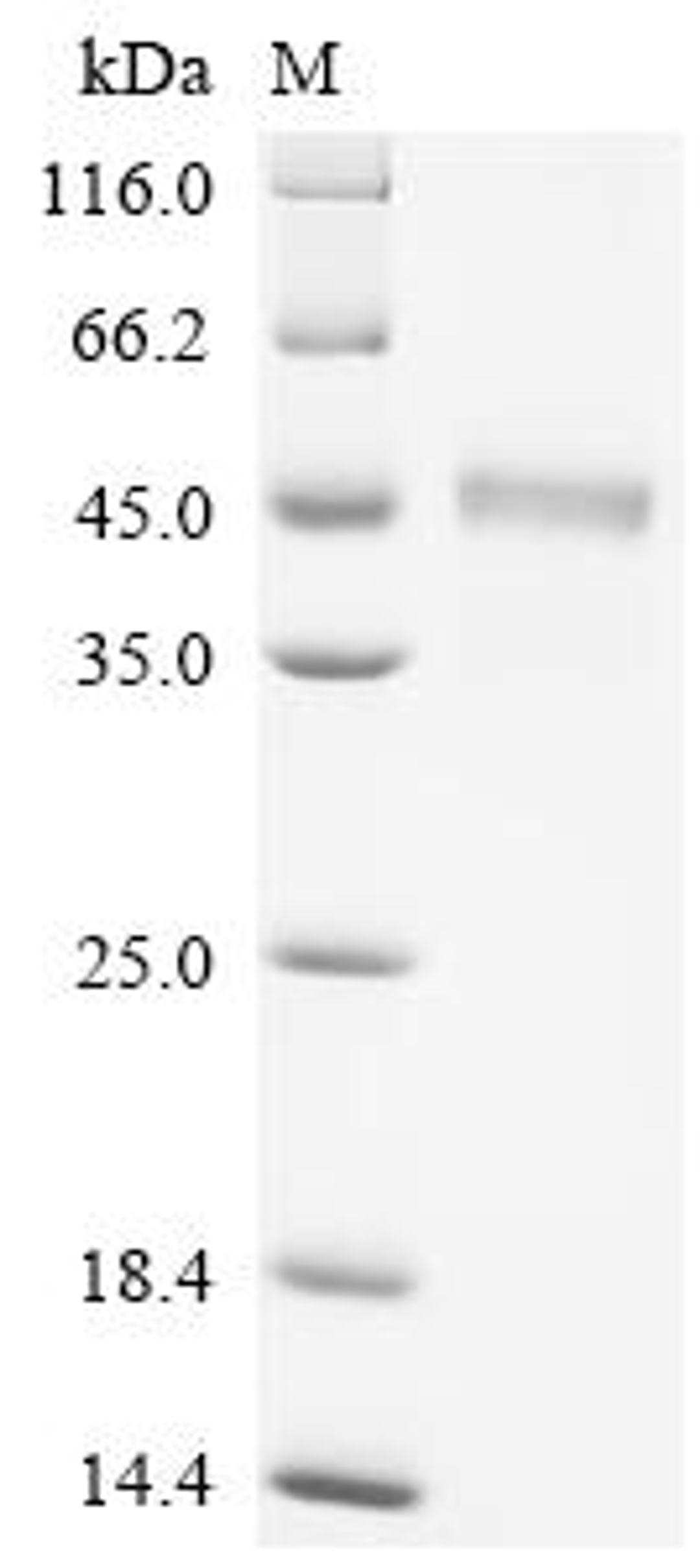 (Tris-Glycine gel) Discontinuous SDS-PAGE (reduced) with 5% enrichment gel and 15% separation gel.