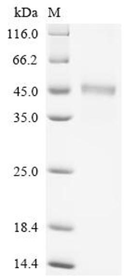 (Tris-Glycine gel) Discontinuous SDS-PAGE (reduced) with 5% enrichment gel and 15% separation gel.