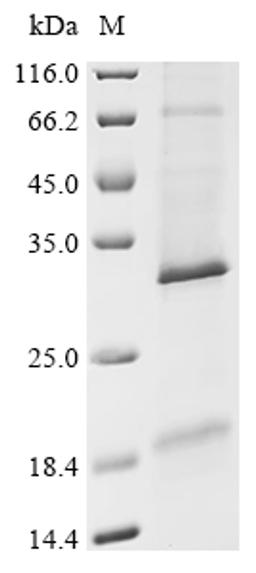 (Tris-Glycine gel) Discontinuous SDS-PAGE (reduced) with 5% enrichment gel and 15% separation gel.