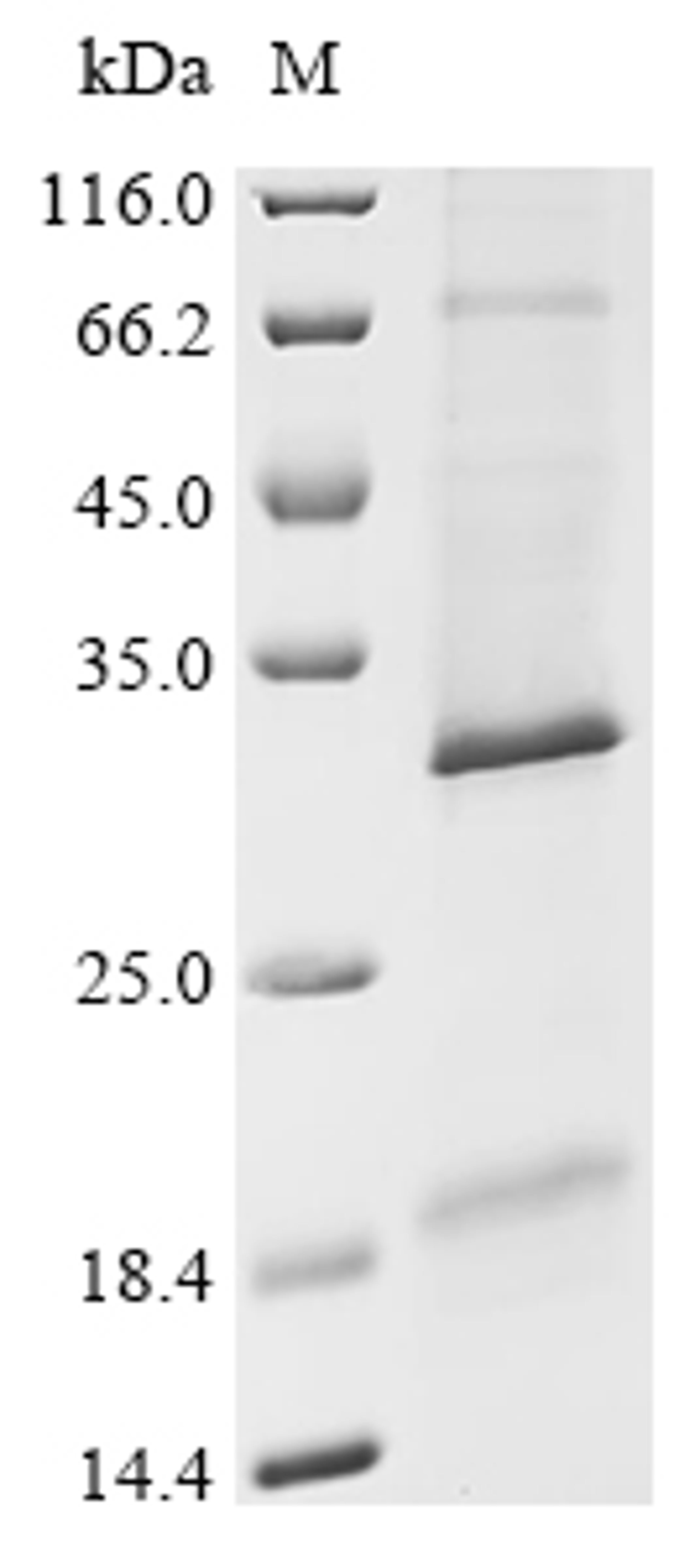 (Tris-Glycine gel) Discontinuous SDS-PAGE (reduced) with 5% enrichment gel and 15% separation gel.