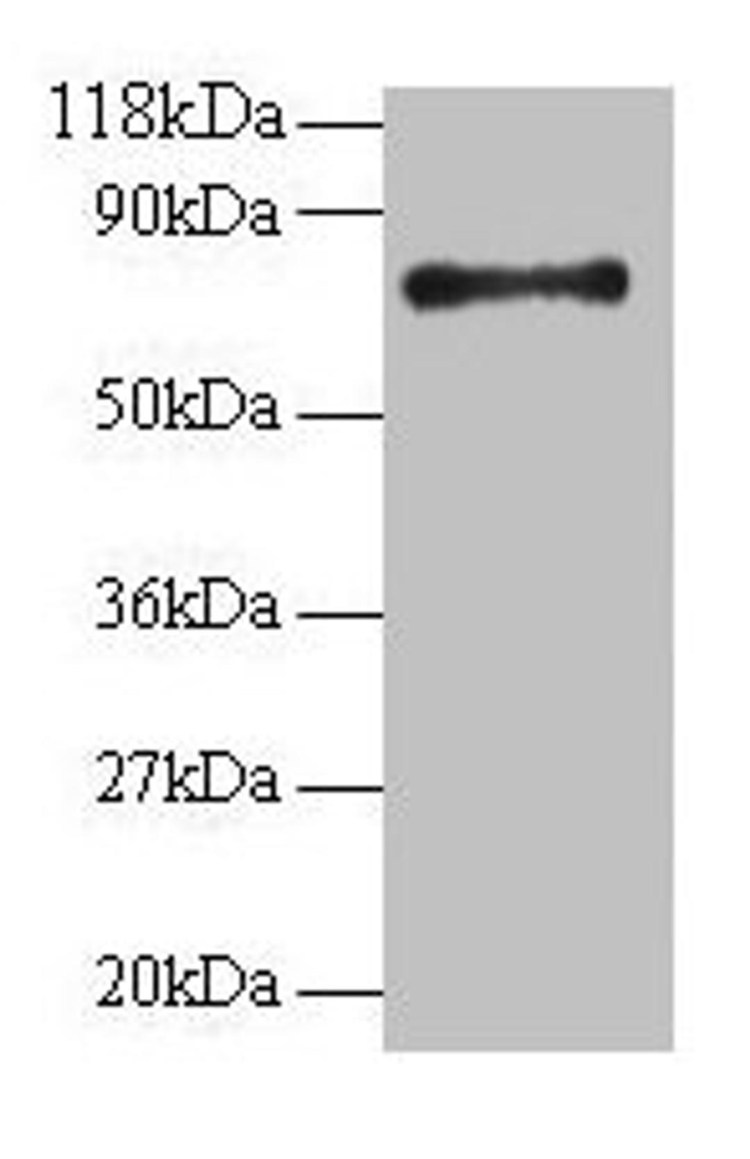 Western blot. All lanes: RPS18 antibody at 2µg/ml + 293T whole cell lysate. Secondary. Goat polyclonal to rabbit IgG at 1/15000 dilution. Predicted band size: 18 kDa. Observed band size: 75 kDa