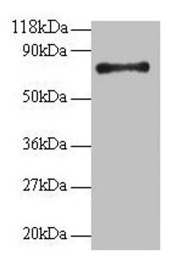 Western blot. All lanes: RPS18 antibody at 2µg/ml + 293T whole cell lysate. Secondary. Goat polyclonal to rabbit IgG at 1/15000 dilution. Predicted band size: 18 kDa. Observed band size: 75 kDa