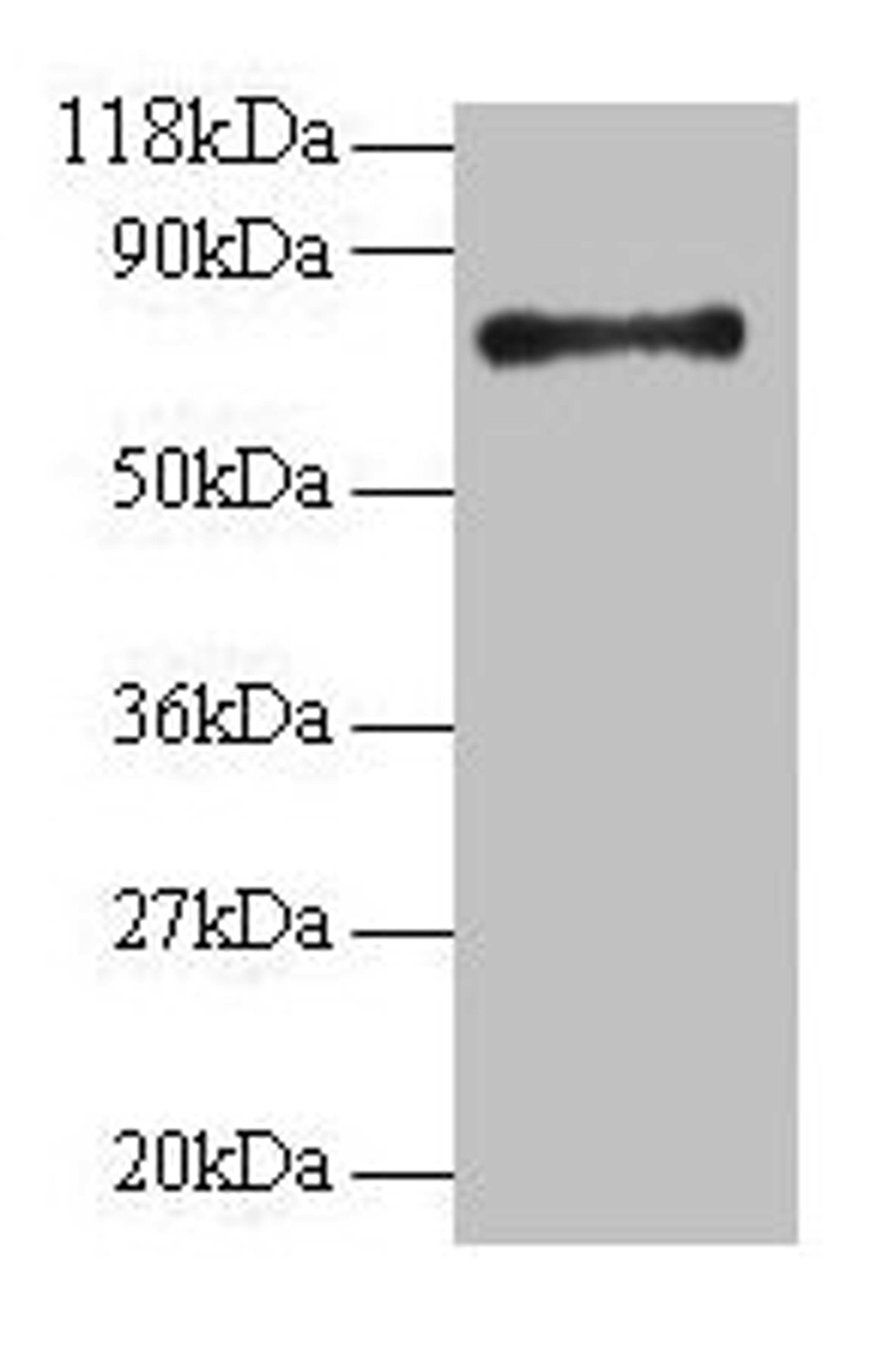 Western blot. All lanes: RPS18 antibody at 2µg/ml + 293T whole cell lysate. Secondary. Goat polyclonal to rabbit IgG at 1/15000 dilution. Predicted band size: 18 kDa. Observed band size: 75 kDa