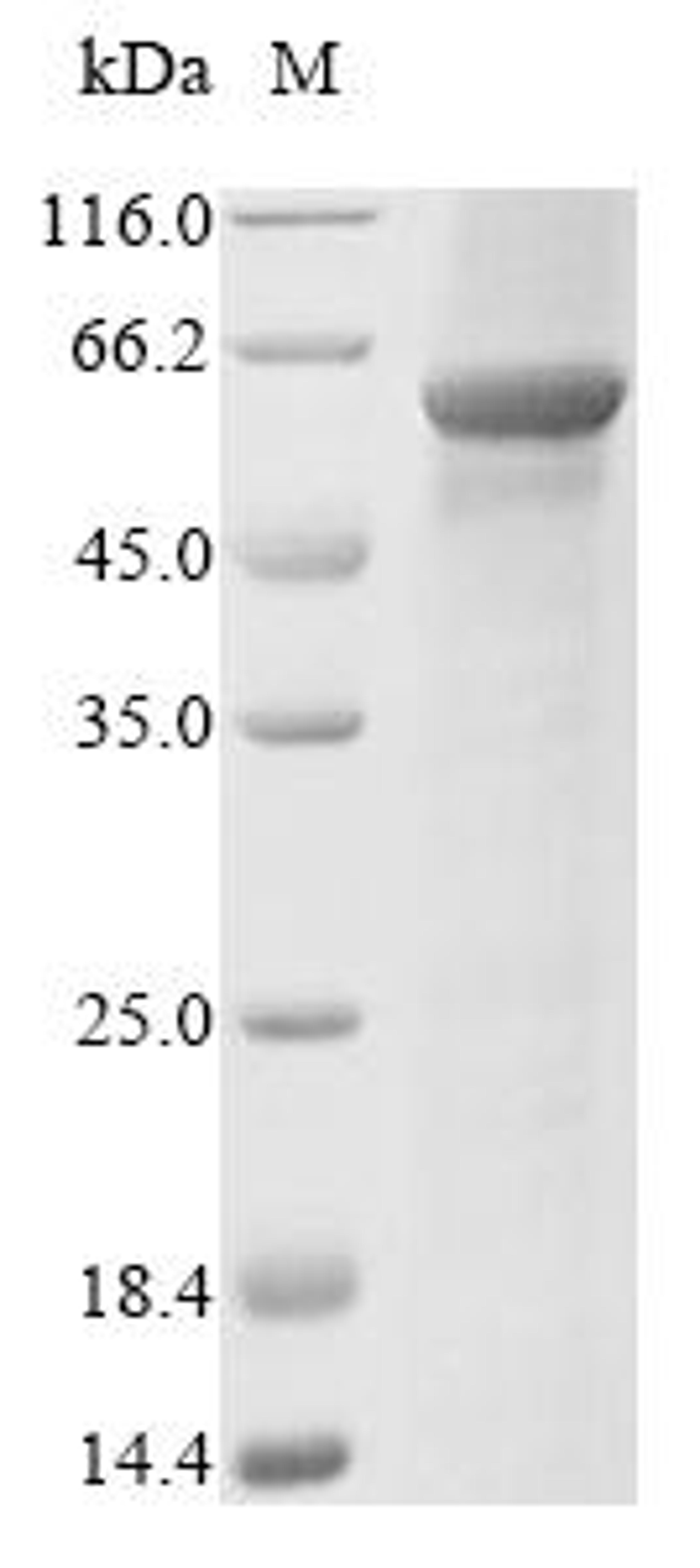 (Tris-Glycine gel) Discontinuous SDS-PAGE (reduced) with 5% enrichment gel and 15% separation gel.