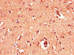 Immunohistochemistry of paraffin-embedded human brain tissue using CSB-PA009901LA01HU at dilution of 1:100