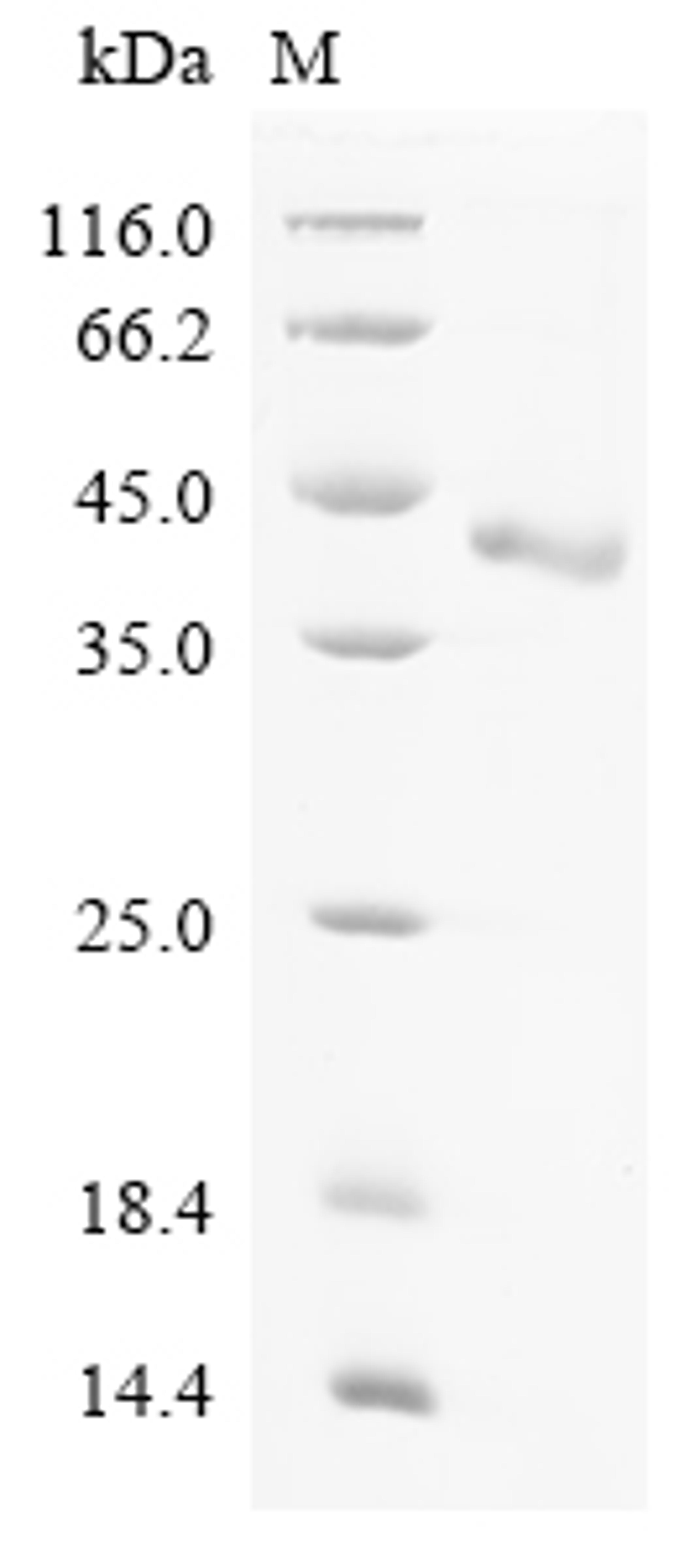 (Tris-Glycine gel) Discontinuous SDS-PAGE (reduced) with 5% enrichment gel and 15% separation gel.