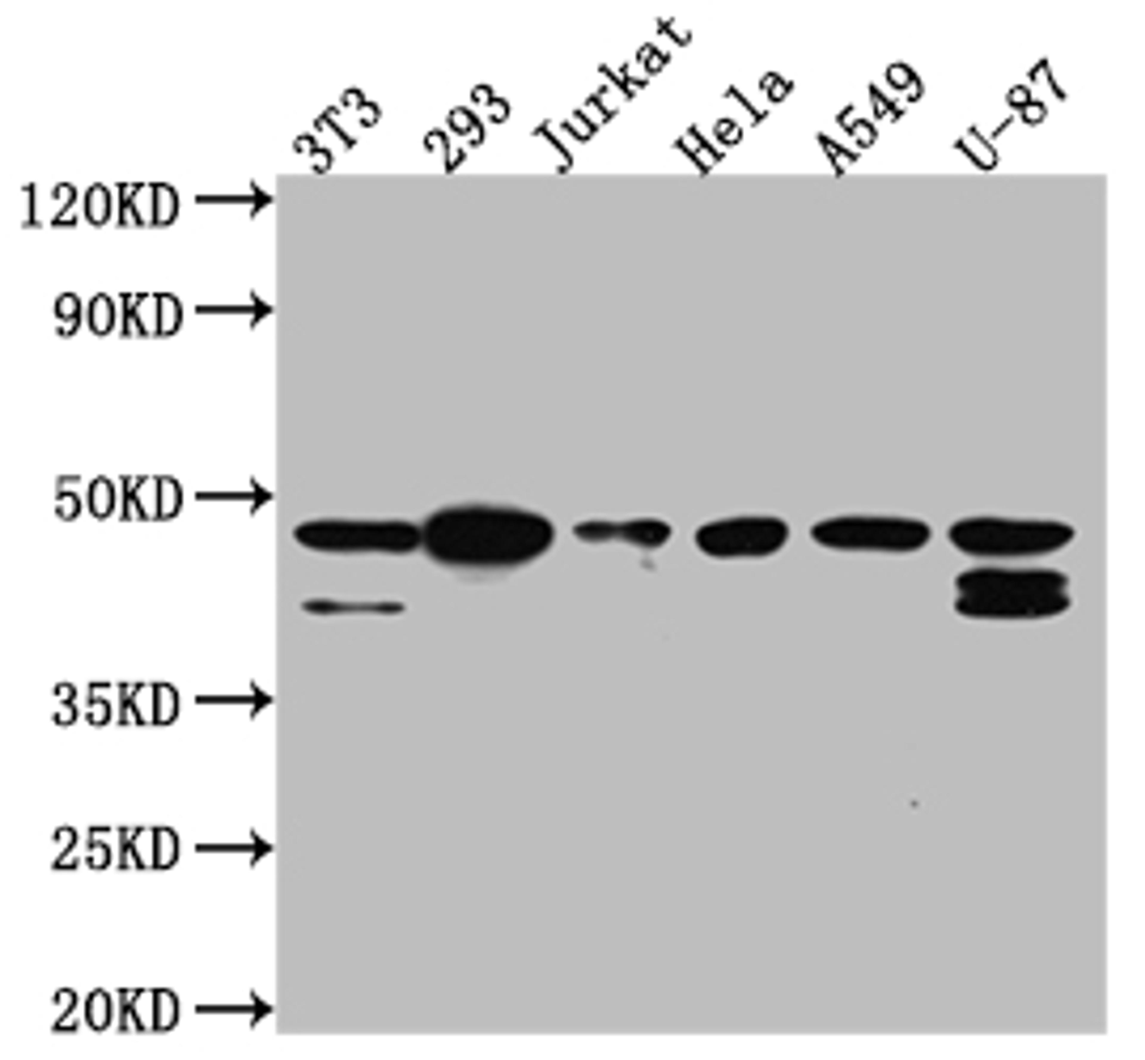 Western Blot. Positive WB detected in: NIH/3T3 whole cell lysate, 293 whole cell lysate, Jurkat whole cell lysate, Hela whole cell lysate, A549 whole cell lysate, U-87 whole cell lysate. All lanes: CKII alpha antibody at 1:1000. Secondary. Goat polyclonal to rabbit IgG at 1/50000 dilution. Predicted band size: 46, 30 kDa. Observed band size: 45 kDa. 