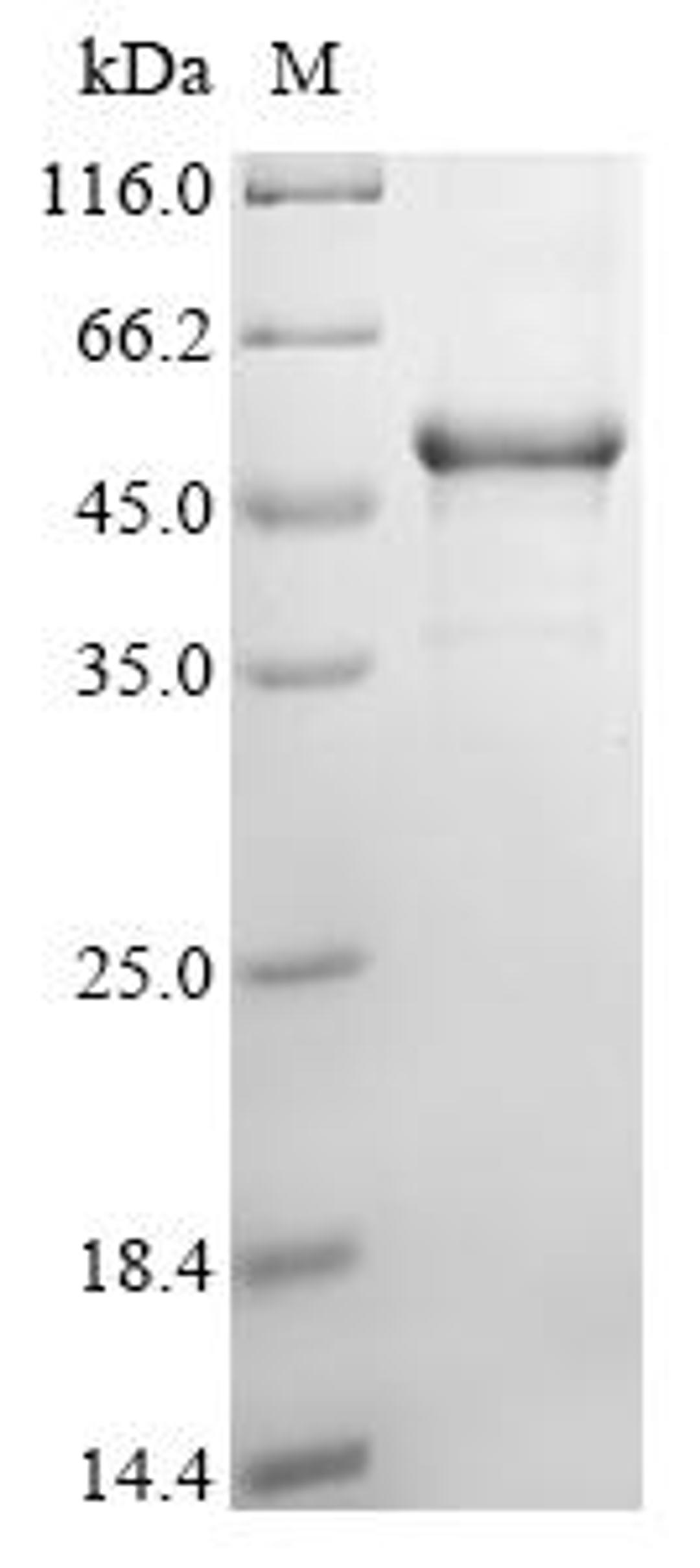 (Tris-Glycine gel) Discontinuous SDS-PAGE (reduced) with 5% enrichment gel and 15% separation gel.