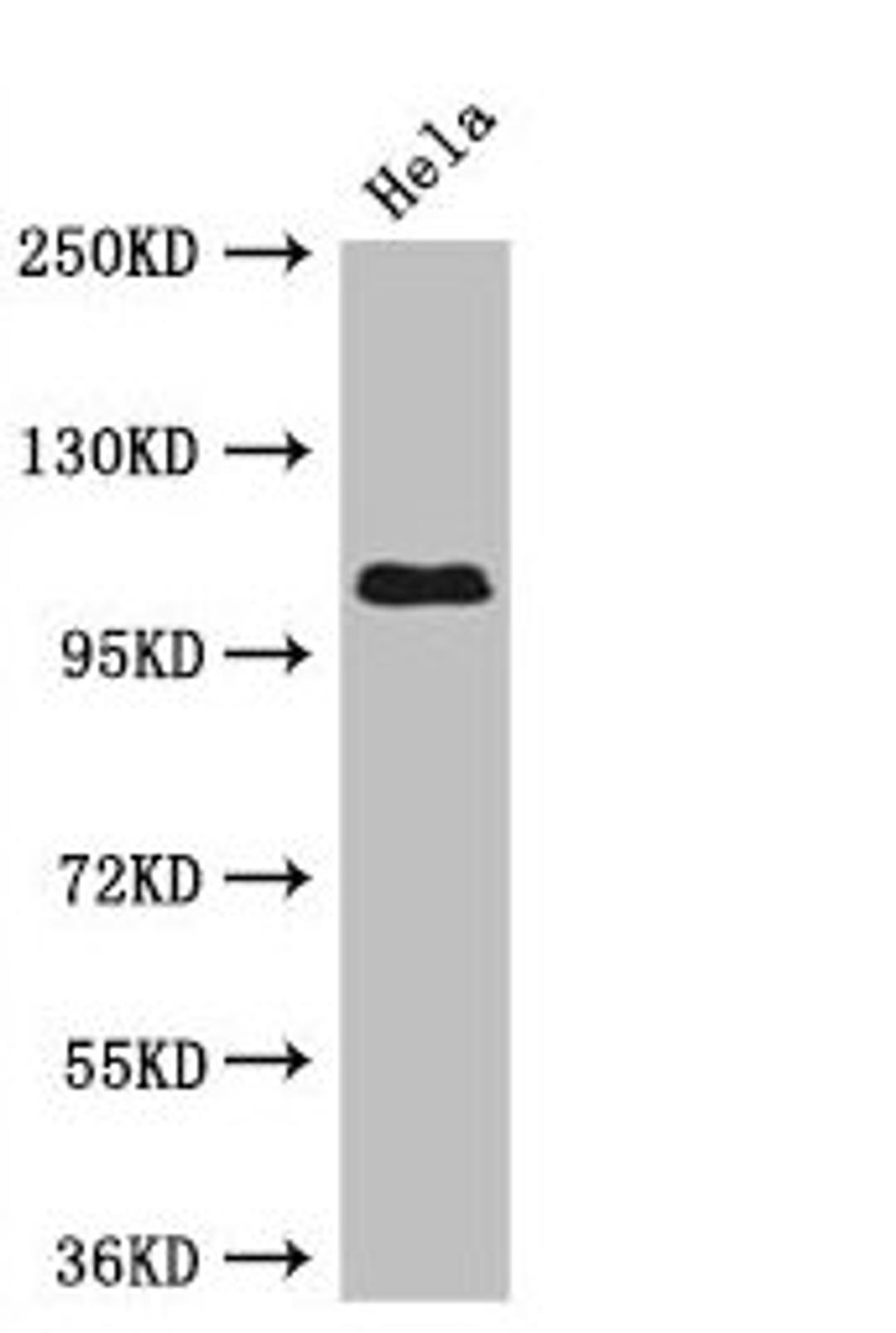 Western Blot. Positive WB detected in: Hela whole cell lysate. All lanes: USP33 antibody at 3µg/ml. Secondary. Goat polyclonal to rabbit IgG at 1/50000 dilution. Predicted band size: 107, 104, 94 kDa. Observed band size: 107 kDa
