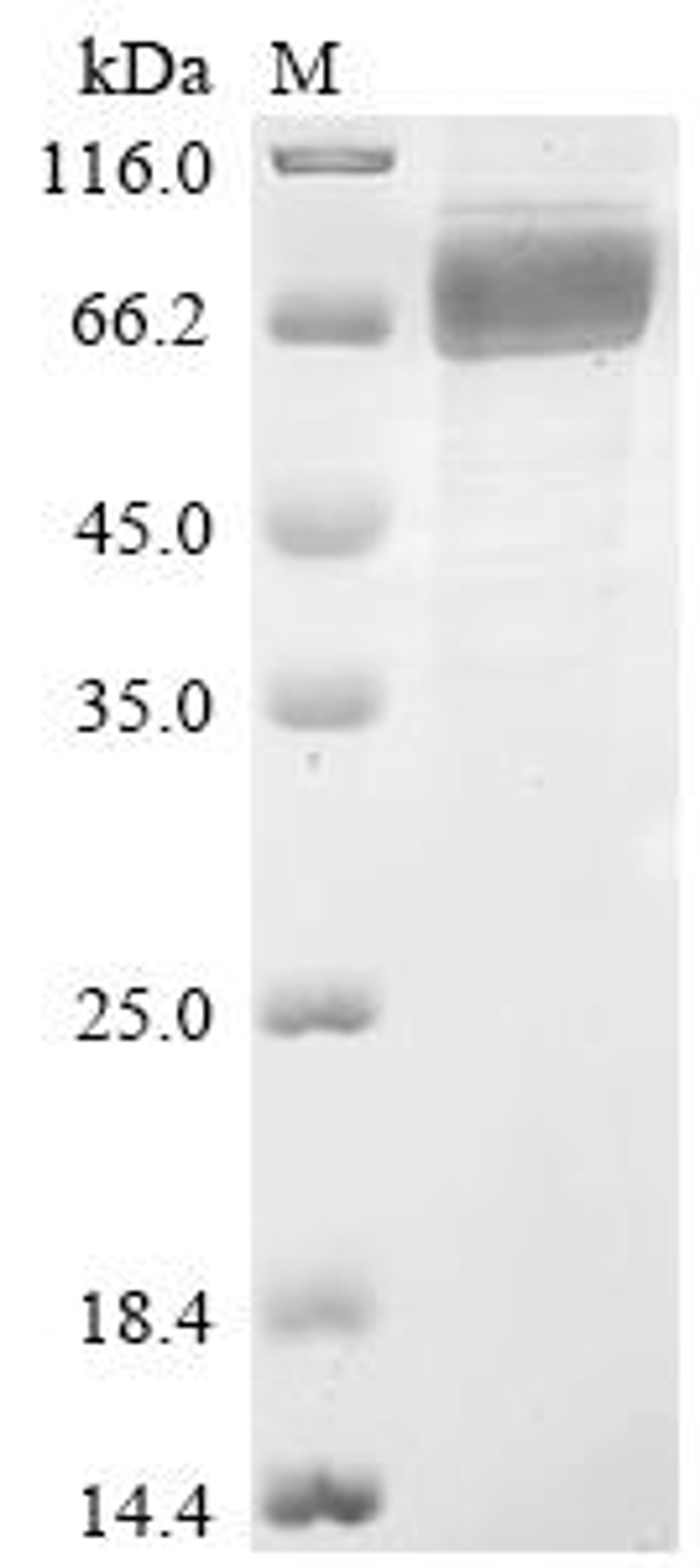 (Tris-Glycine gel) Discontinuous SDS-PAGE (reduced) with 5% enrichment gel and 15% separation gel.