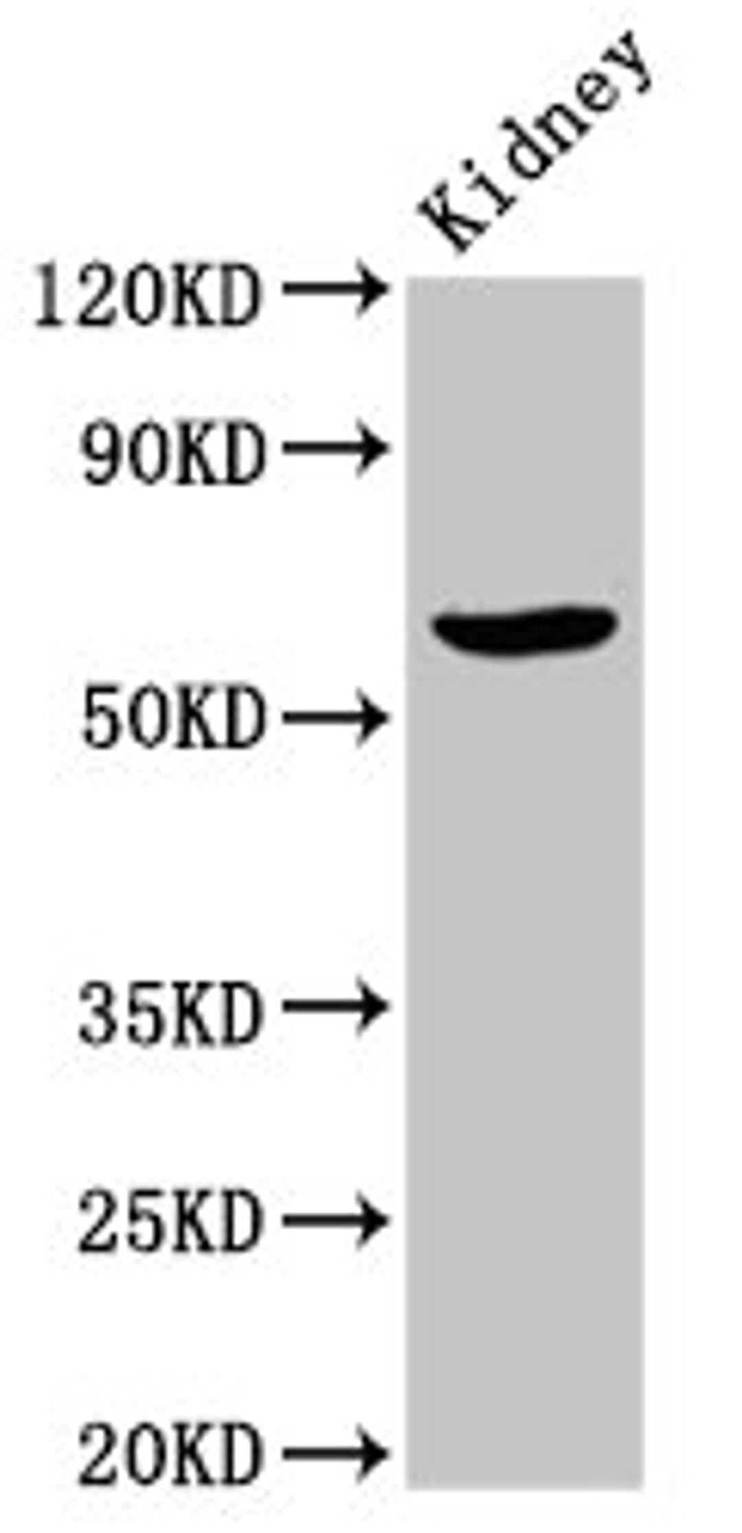 Western Blot. Positive WB detected in: Rat kidney tissue. All lanes: ACBD3 antibody at 7ug/ml. Secondary. Goat polyclonal to rabbit IgG at 1/50000 dilution. Predicted band size: 61 kDa. Observed band size: 61 kDa. 
