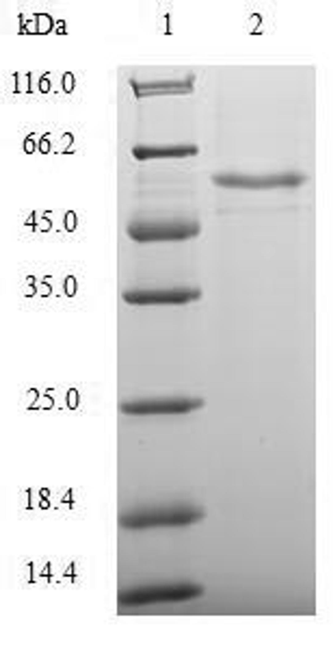 (Tris-Glycine gel) Discontinuous SDS-PAGE (reduced) with 5% enrichment gel and 15% separation gel.