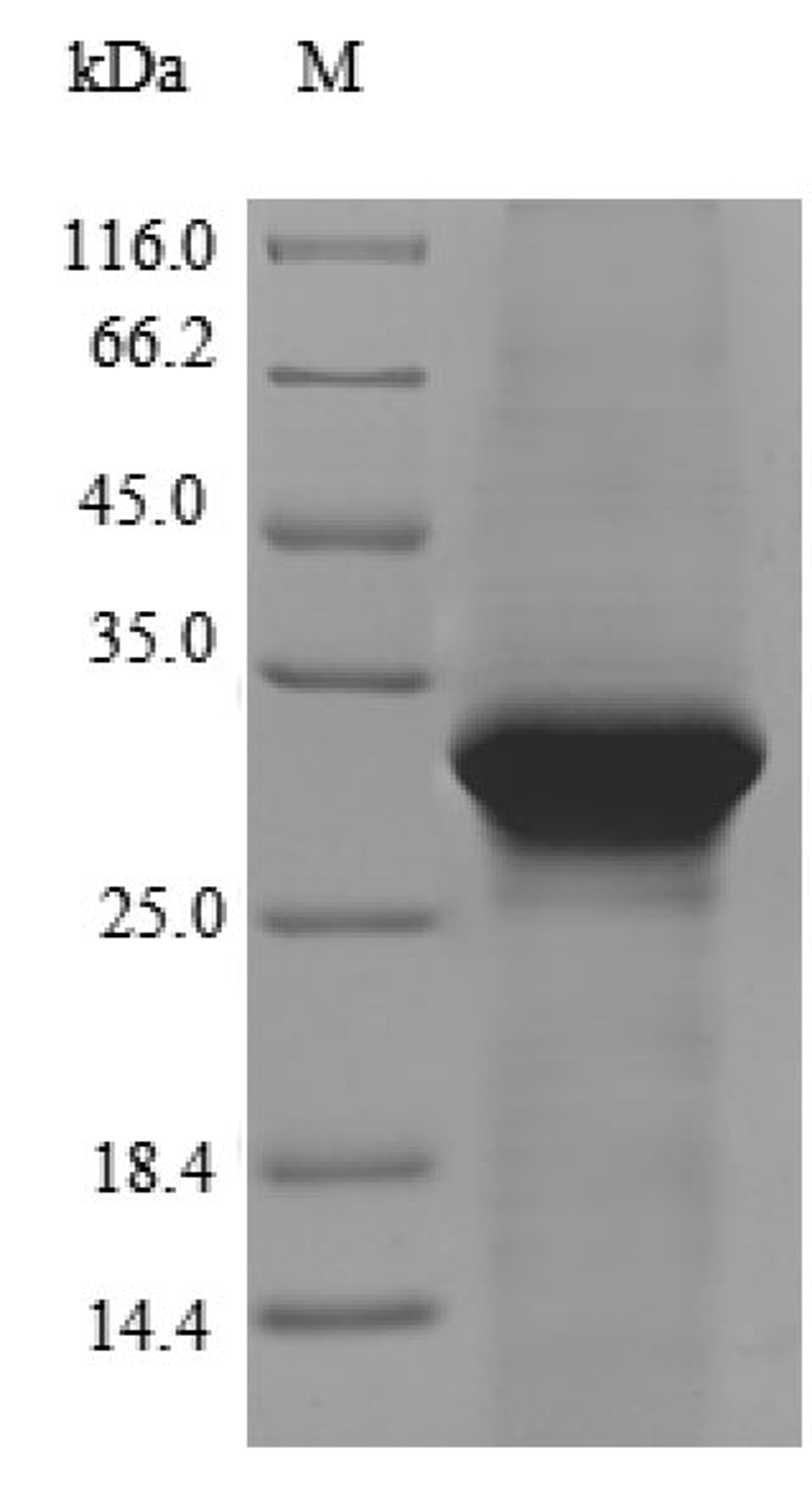 (Tris-Glycine gel) Discontinuous SDS-PAGE (reduced) with 5% enrichment gel and 15% separation gel.