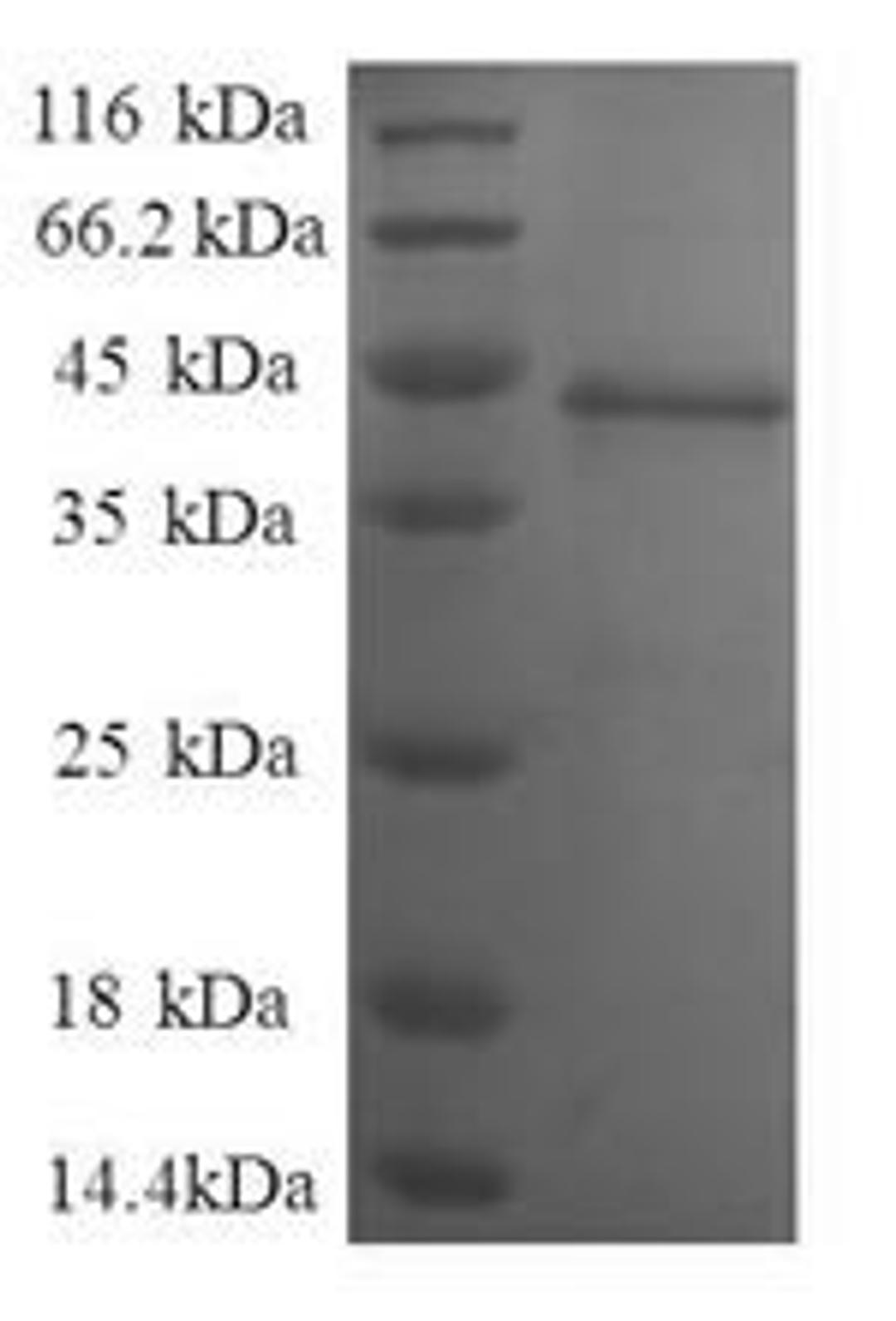(Tris-Glycine gel) Discontinuous SDS-PAGE (reduced) with 5% enrichment gel and 15% separation gel.