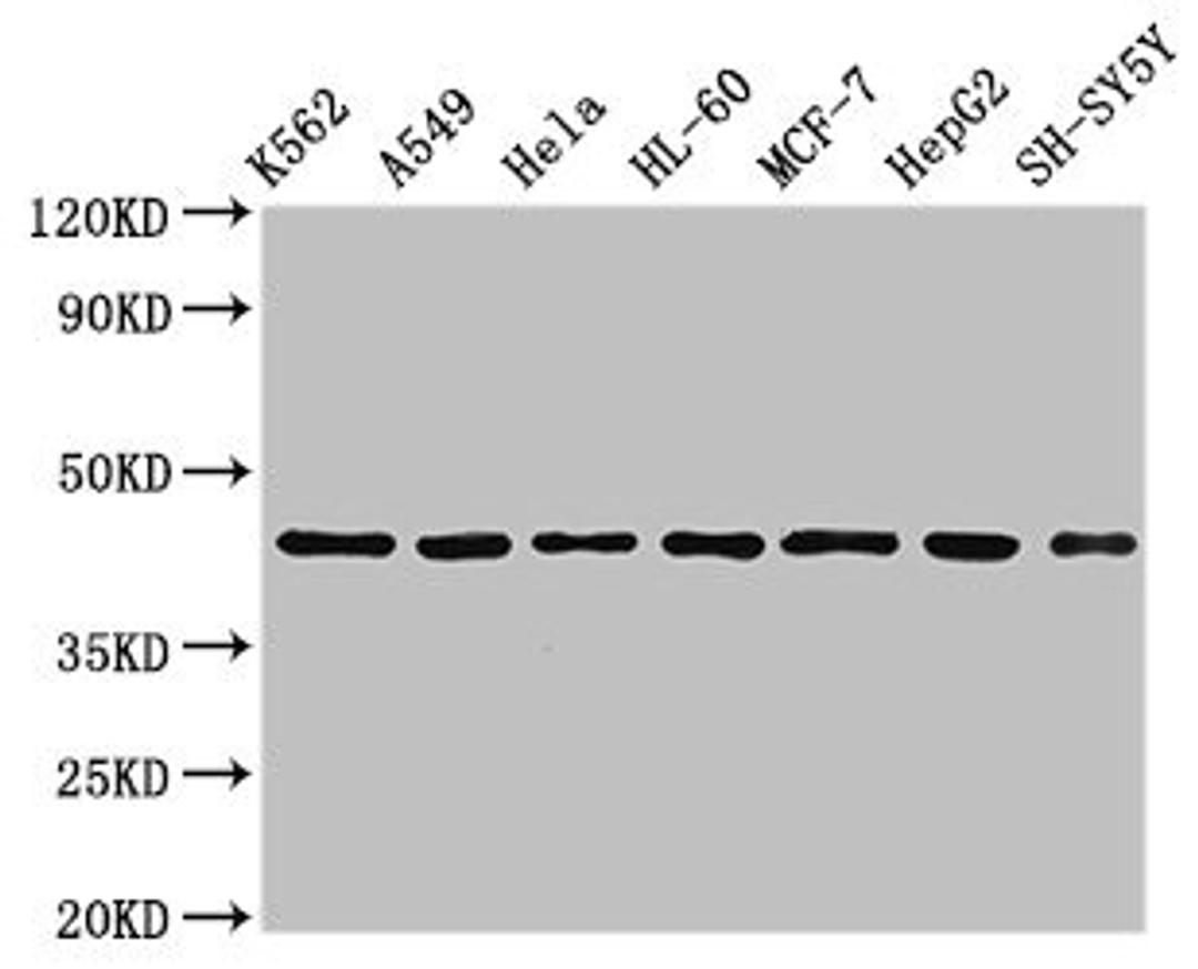 Western Blot. Positive WB detected in: K562 whole cell lysate, A549 whole cell lysate, Hela whole cell lysate, HL60 whole cell lyasate, MCF-7 whole cell lysate, HepG2 whole cell lysate, SH-SY5Y whole cell lysate. All lanes: TARDBP antibody at 2.5µg/ml. Secondary. Goat polyclonal to rabbit IgG at 1/50000 dilution. Predicted band size: 45, 32 kDa. Observed band size: 45 kDa