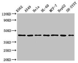 Western Blot. Positive WB detected in: K562 whole cell lysate, A549 whole cell lysate, Hela whole cell lysate, HL60 whole cell lyasate, MCF-7 whole cell lysate, HepG2 whole cell lysate, SH-SY5Y whole cell lysate. All lanes: TARDBP antibody at 2.5µg/ml. Secondary. Goat polyclonal to rabbit IgG at 1/50000 dilution. Predicted band size: 45, 32 kDa. Observed band size: 45 kDa