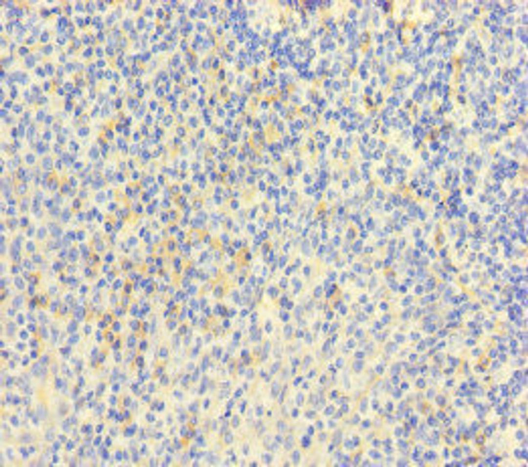 Immunohistochemistry of paraffin-embedded human tonsil tissue using CSB-PA014755LA01HU at dilution of 1:100