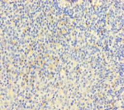 Immunohistochemistry of paraffin-embedded human tonsil tissue using CSB-PA014755LA01HU at dilution of 1:100