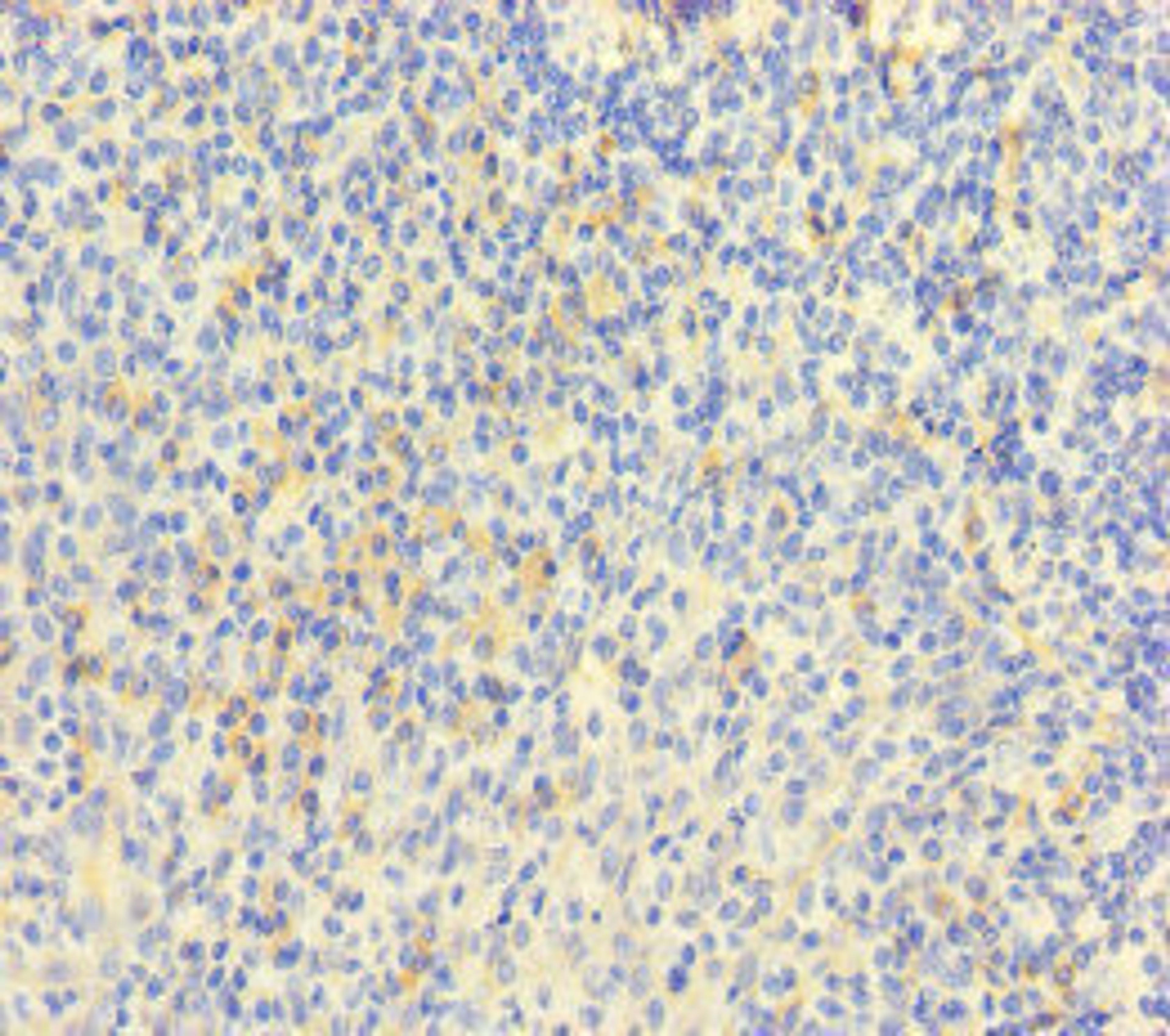 Immunohistochemistry of paraffin-embedded human tonsil tissue using CSB-PA014755LA01HU at dilution of 1:100