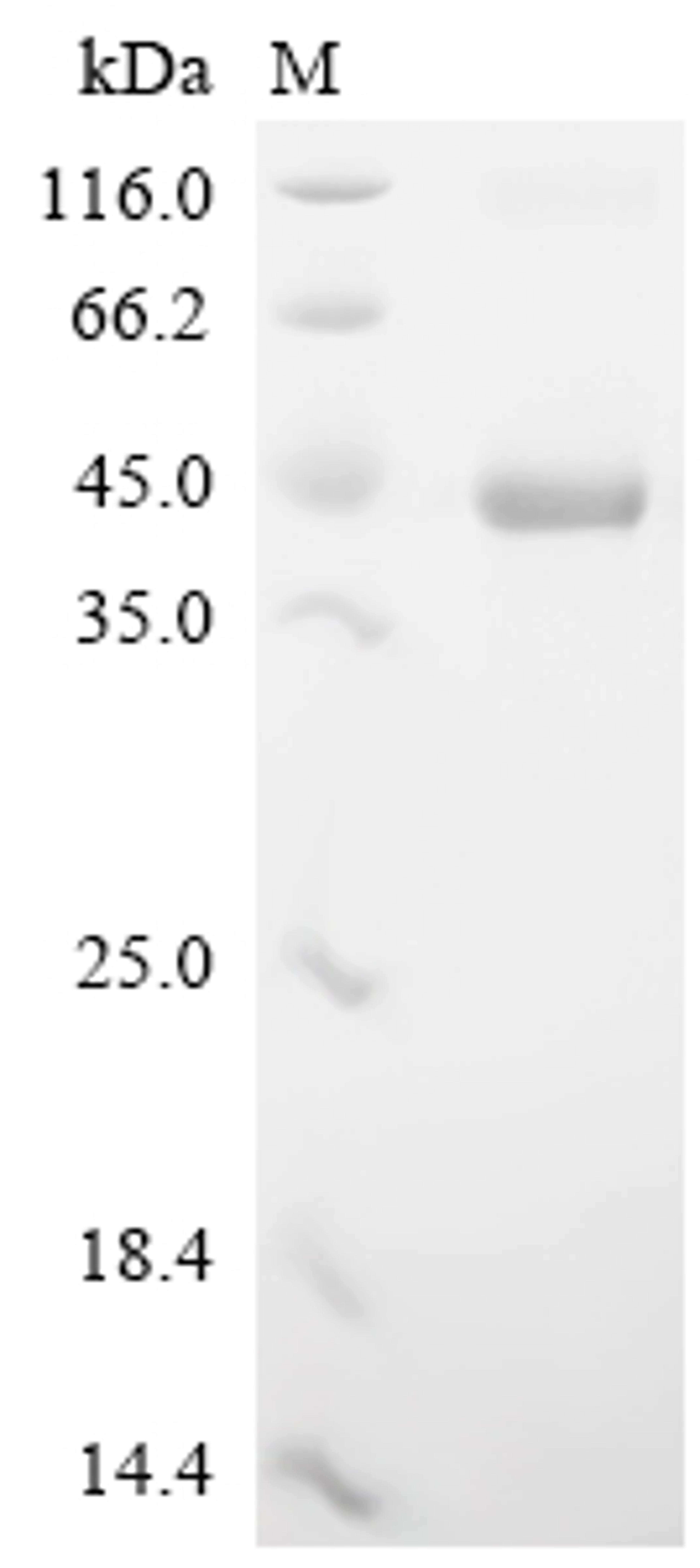 (Tris-Glycine gel) Discontinuous SDS-PAGE (reduced) with 5% enrichment gel and 15% separation gel.