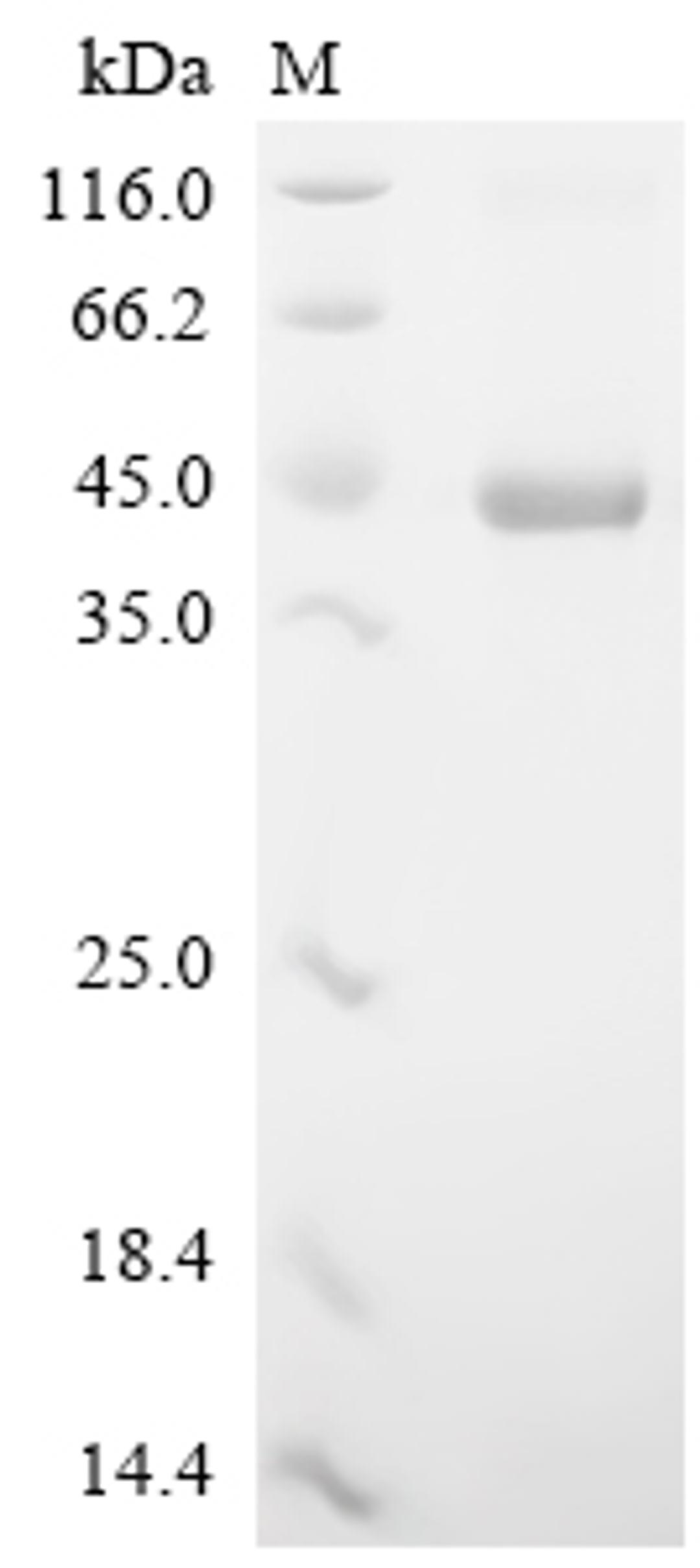 (Tris-Glycine gel) Discontinuous SDS-PAGE (reduced) with 5% enrichment gel and 15% separation gel.