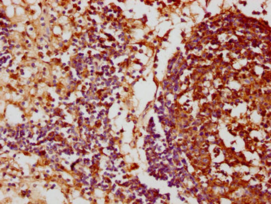 IHC image of CSB-PA853475LA01HU diluted at 1:100 and staining in paraffin-embedded human lymph node tissue performed on a Leica BondTM system. After dewaxing and hydration, antigen retrieval was mediated by high pressure in a citrate buffer (pH 6.0). Section was blocked with 10% normal goat serum 30min at RT. Then primary antibody (1% BSA) was incubated at 4&deg;C overnight. The primary is detected by a biotinylated secondary antibody and visualized using an HRP conjugated SP system.