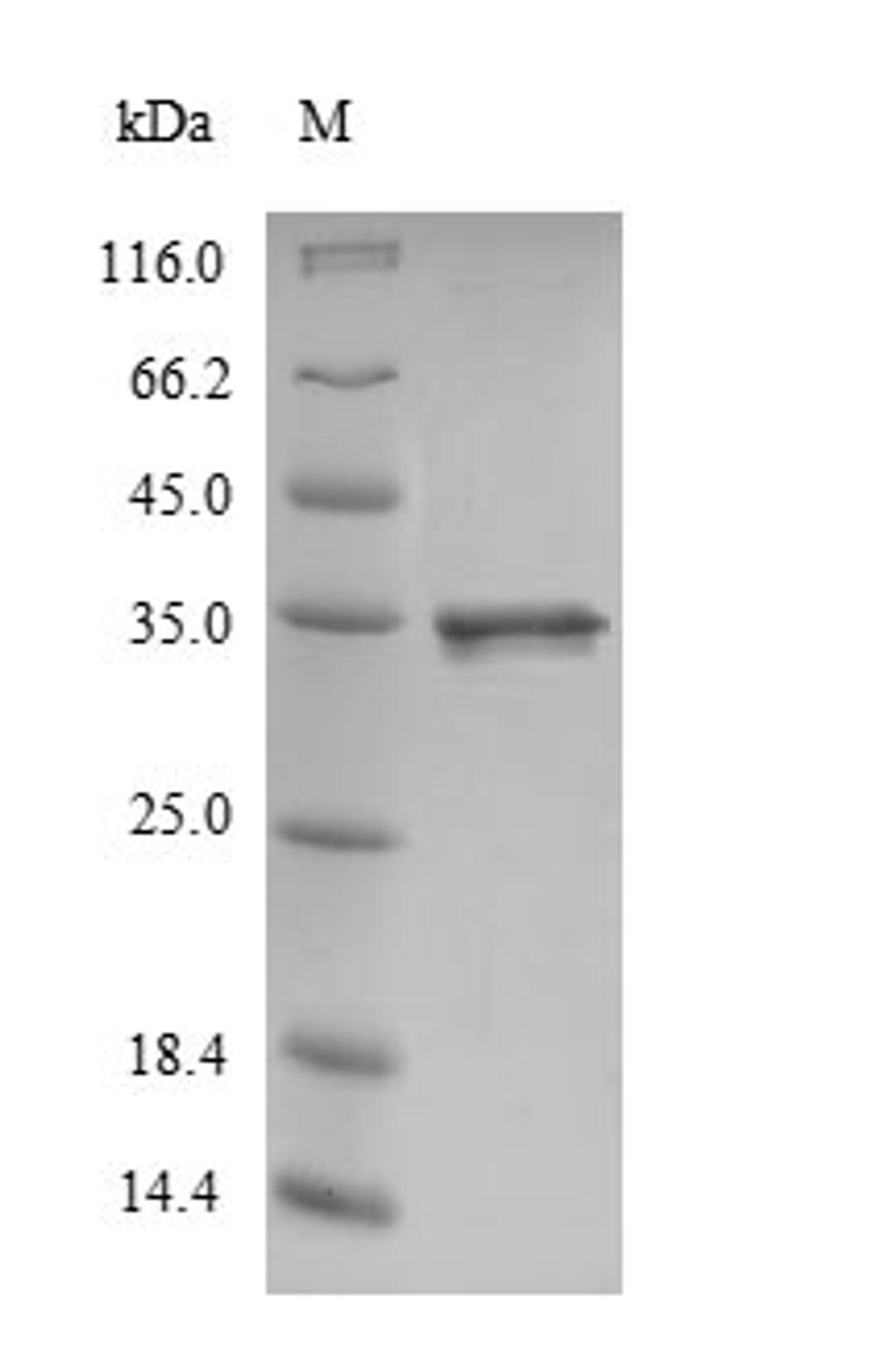 (Tris-Glycine gel) Discontinuous SDS-PAGE (reduced) with 5% enrichment gel and 15% separation gel.