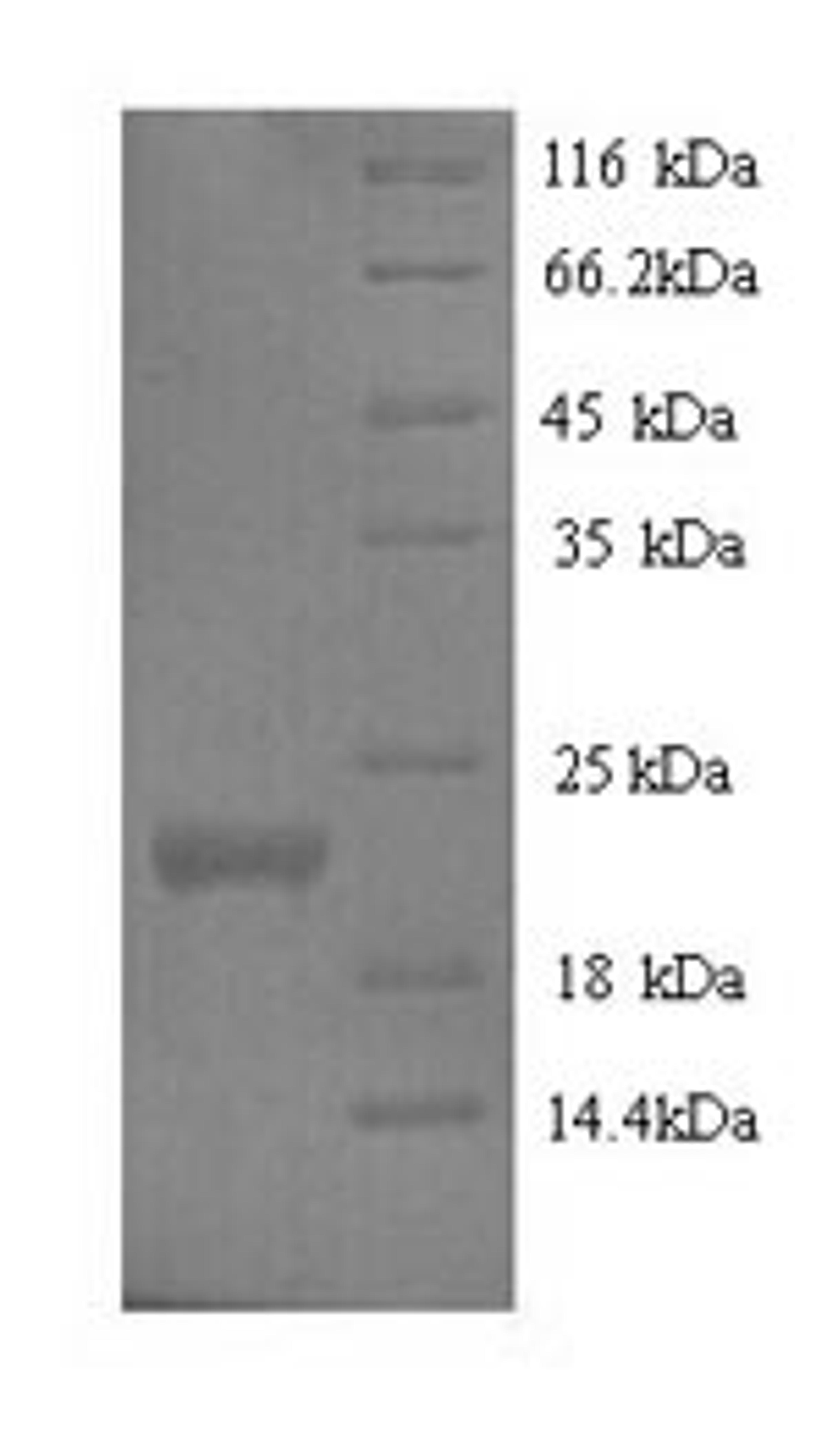 (Tris-Glycine gel) Discontinuous SDS-PAGE (reduced) with 5% enrichment gel and 15% separation gel.