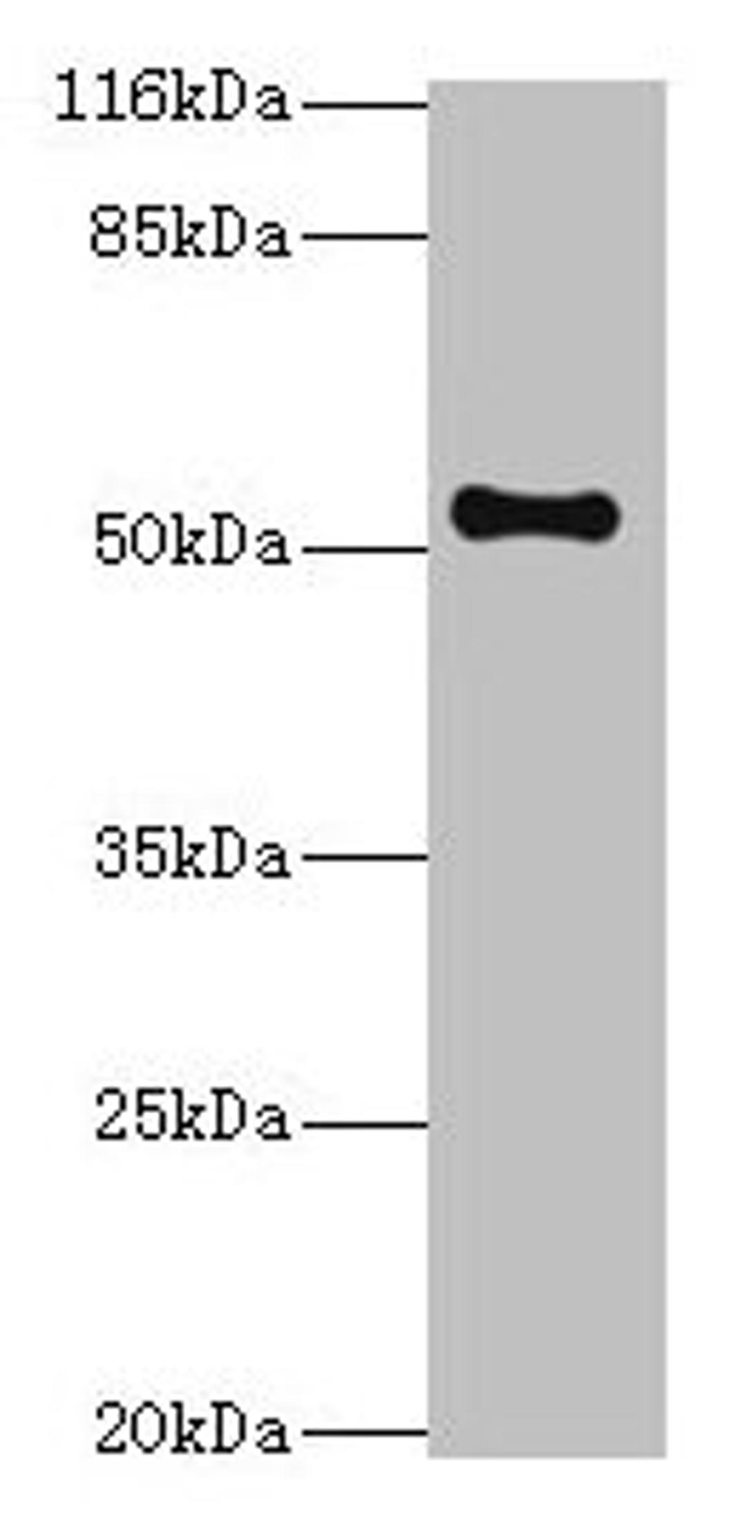 Western blot. All lanes: THRB antibody at 2µg/ml + Mouse liver tissue. Secondary. Goat polyclonal to rabbit IgG at 1/10000 dilution. Predicted band size: 53, 55 kDa. Observed band size: 53 kDa