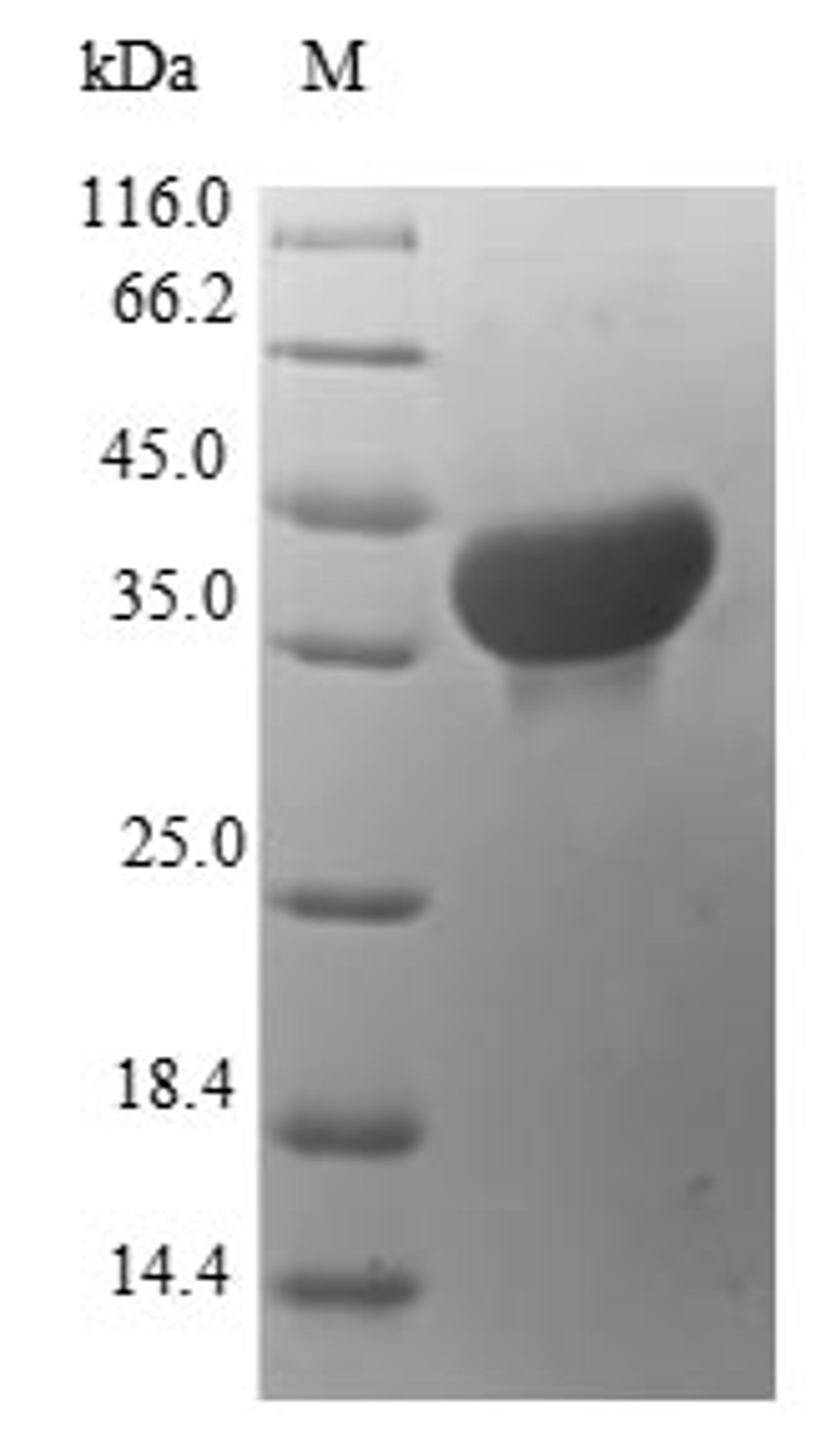 (Tris-Glycine gel) Discontinuous SDS-PAGE (reduced) with 5% enrichment gel and 15% separation gel.