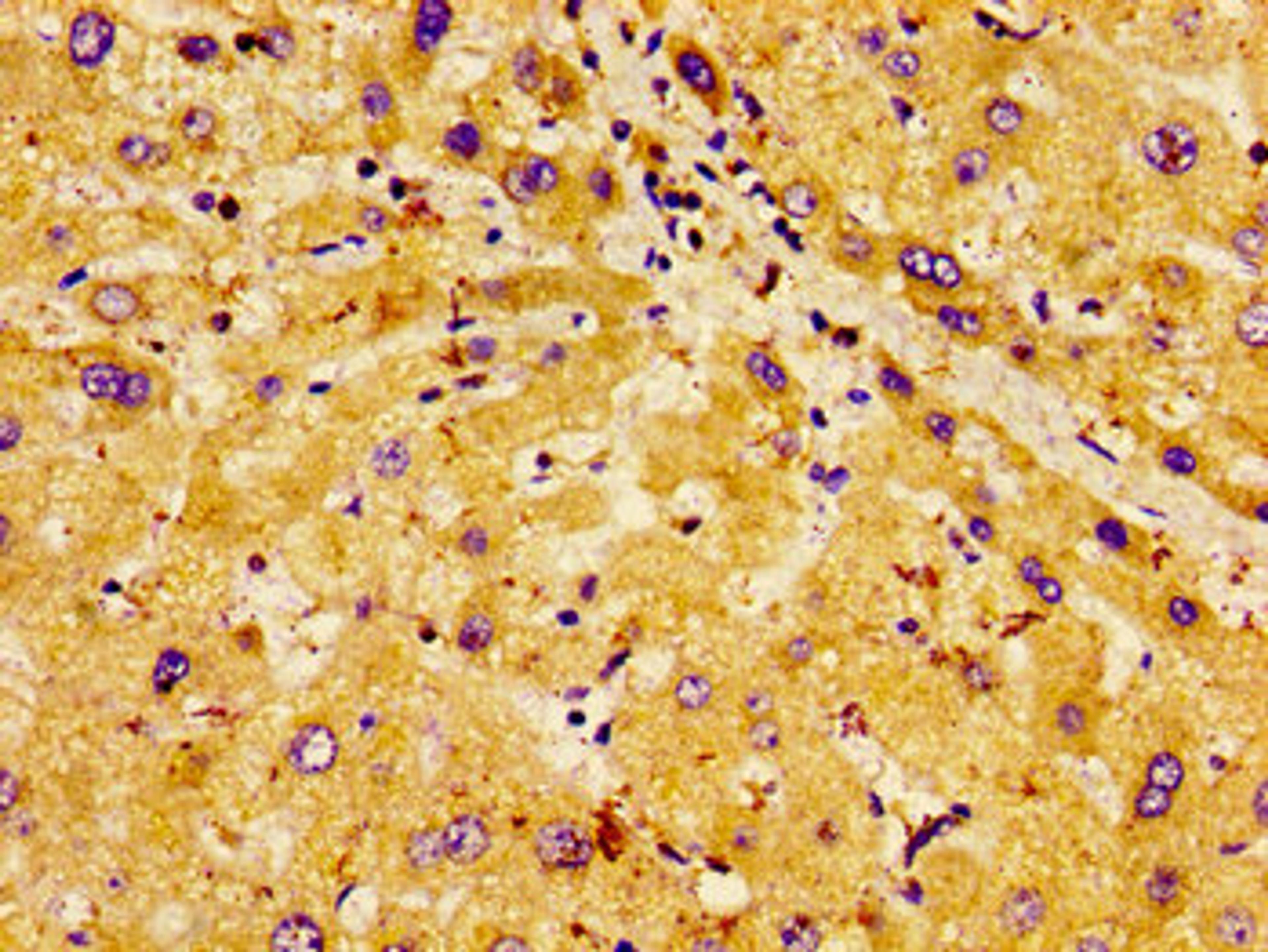 Immunohistochemistry of paraffin-embedded human liver tissue using CSB-PA845148LA01HU at dilution of 1: 100
