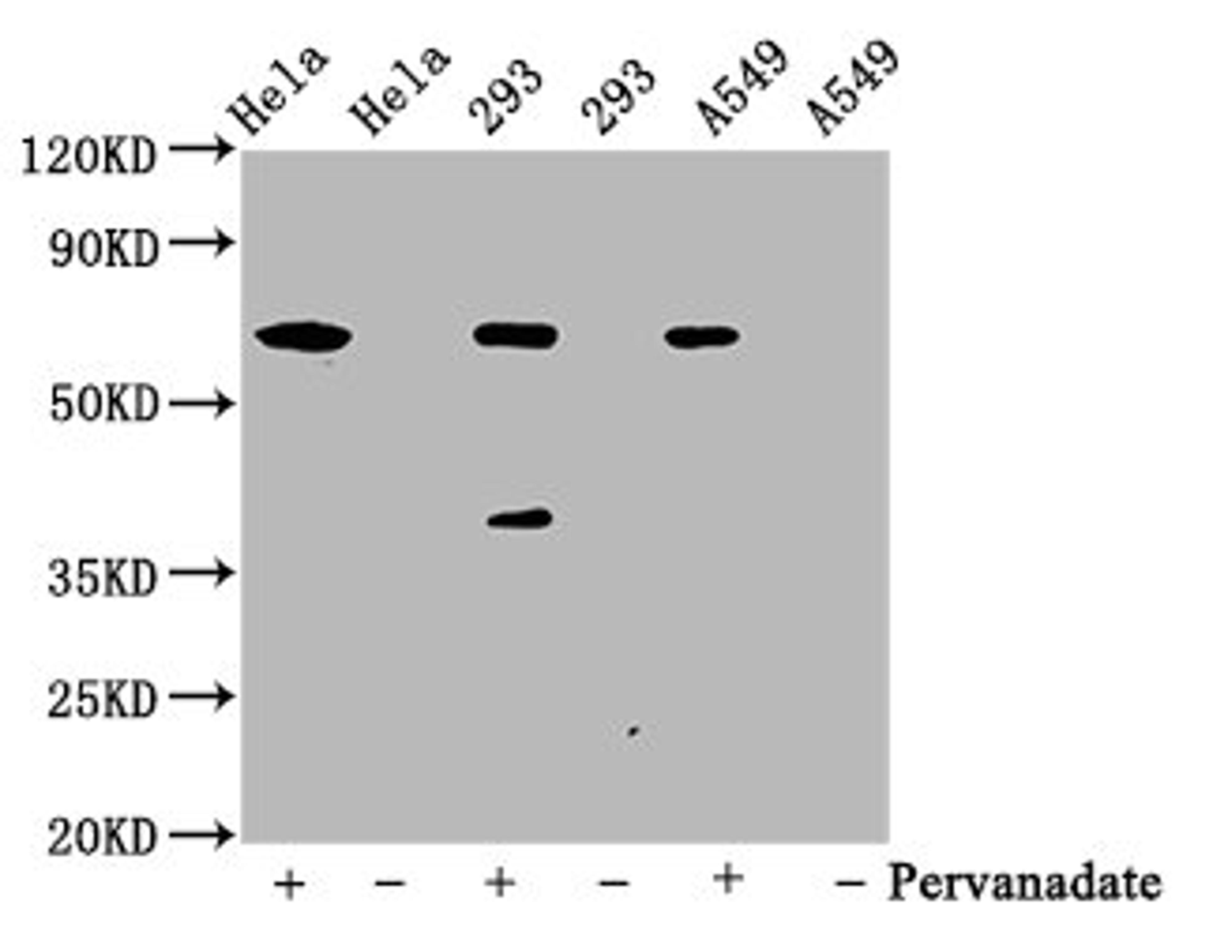 Western Blot. Positive WB detected in Hela whole cell lysate锛?93 whole cell lysate锛孉549 whole cell lysate(treated with Pervanadate or not). All lanes Phospho-PTPN11 antibody at 0.65μg/ml. Secondary. Goat polyclonal to rabbit IgG at 1/50000 dilution. Predicted band size: 68 KDa. Observed band size: 68 KDa.