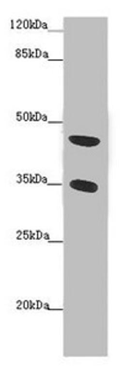 Western blot. All lanes: TENT5C antibody at 2 µg/ml + Mouse heart tissue. Secondary. Goat polyclonal to rabbit IgG at 1/10000 dilution. Predicted band size: 45 kDa. Observed band size: 45, 35 kDa