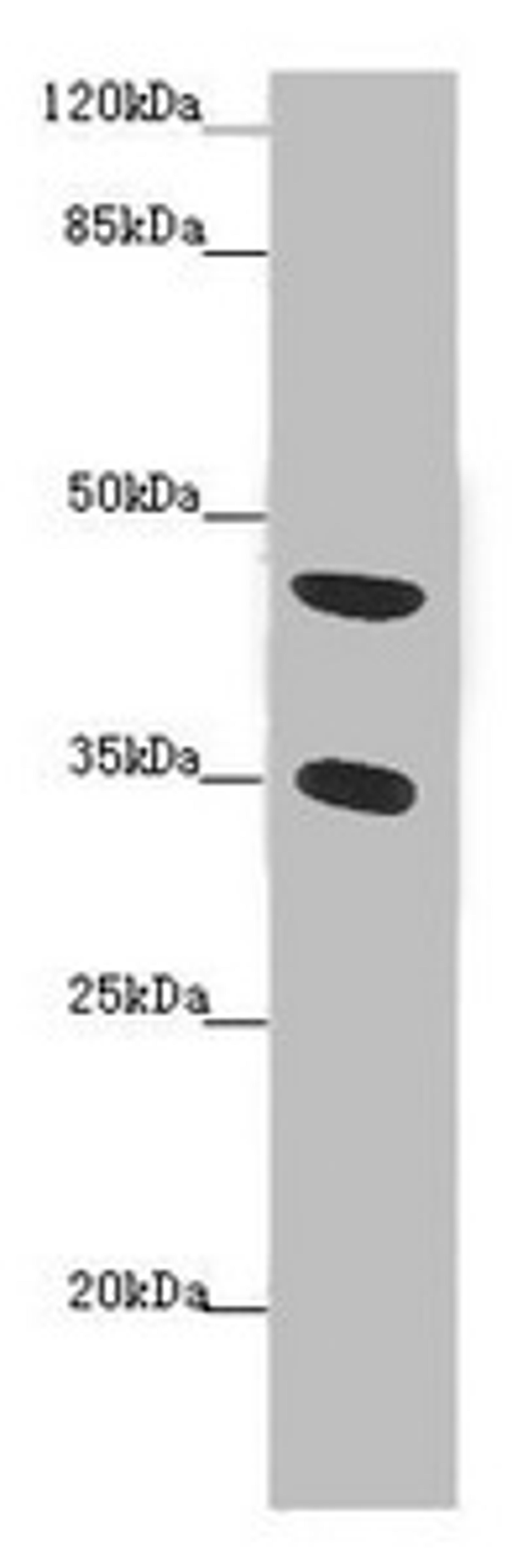 Western blot. All lanes: TENT5C antibody at 2 µg/ml + Mouse heart tissue. Secondary. Goat polyclonal to rabbit IgG at 1/10000 dilution. Predicted band size: 45 kDa. Observed band size: 45, 35 kDa