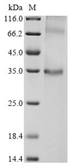 (Tris-Glycine gel) Discontinuous SDS-PAGE (reduced) with 5% enrichment gel and 15% separation gel.