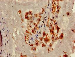 Immunohistochemistry of paraffin-embedded human placenta tissue using CSB-PA004572LA01HU at dilution of 1:100
