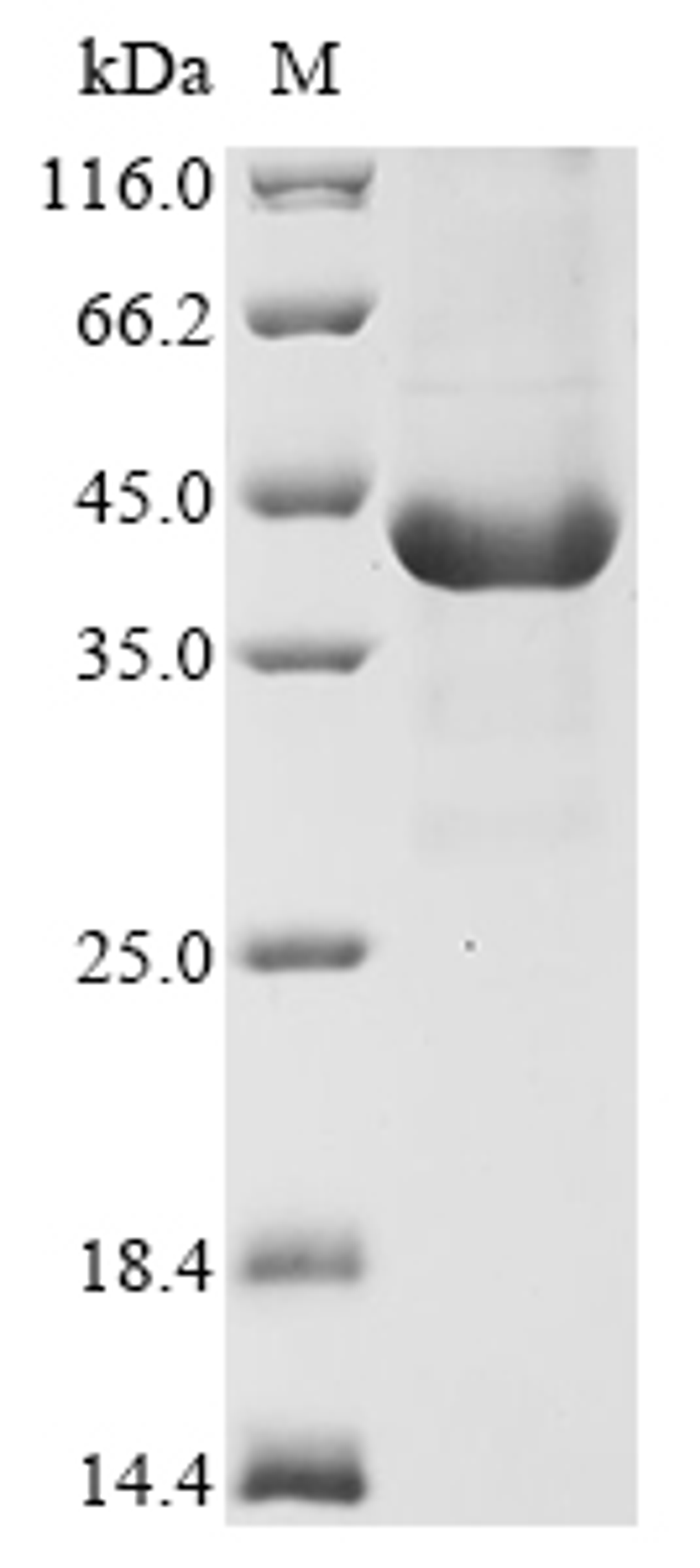 (Tris-Glycine gel) Discontinuous SDS-PAGE (reduced) with 5% enrichment gel and 15% separation gel.