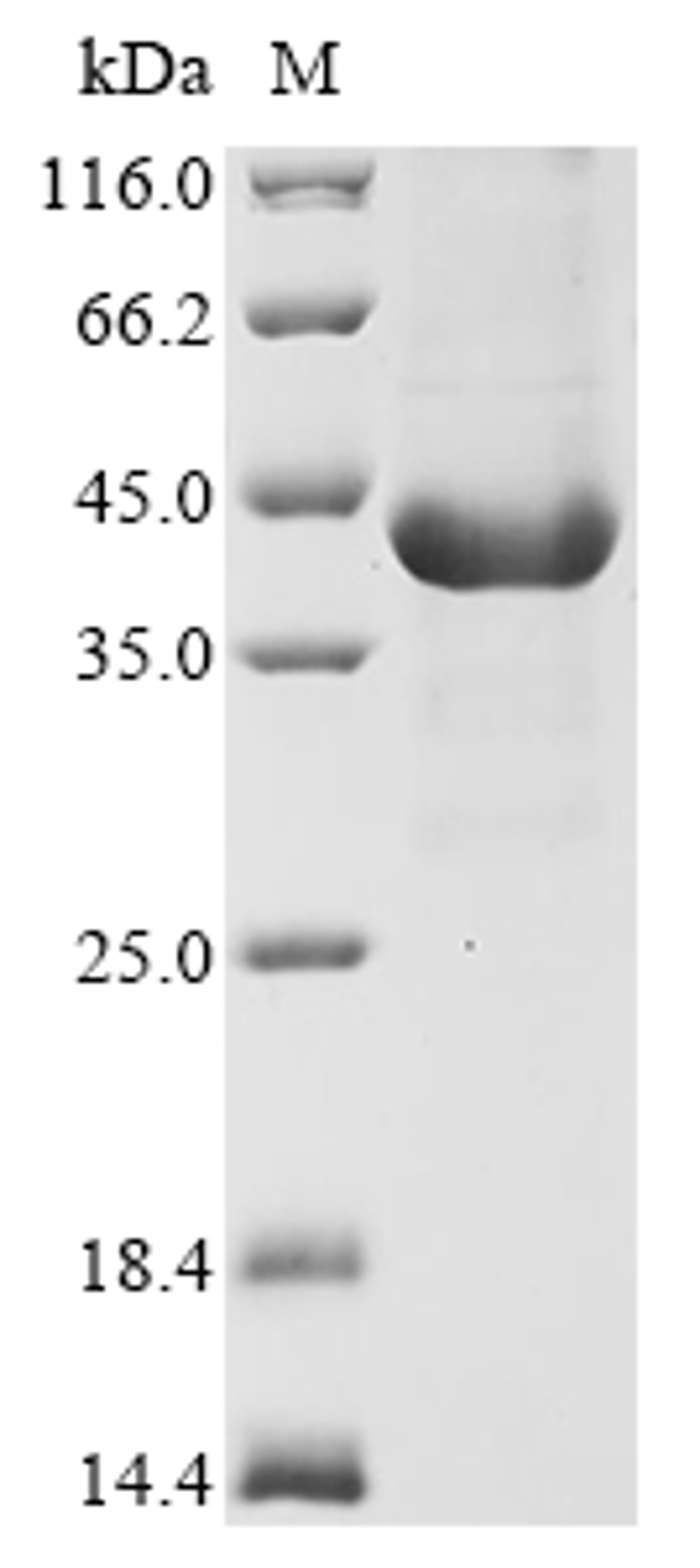 (Tris-Glycine gel) Discontinuous SDS-PAGE (reduced) with 5% enrichment gel and 15% separation gel.