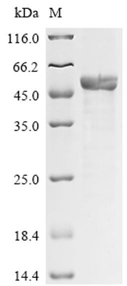 (Tris-Glycine gel) Discontinuous SDS-PAGE (reduced) with 5% enrichment gel and 15% separation gel.