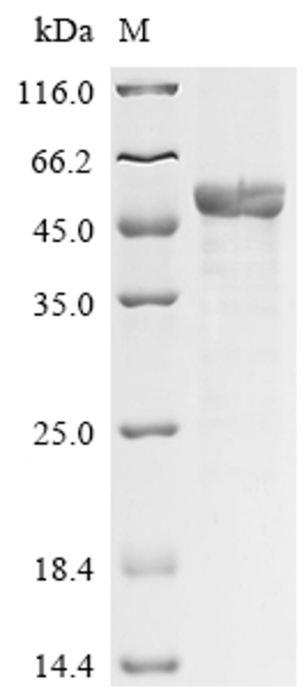 (Tris-Glycine gel) Discontinuous SDS-PAGE (reduced) with 5% enrichment gel and 15% separation gel.