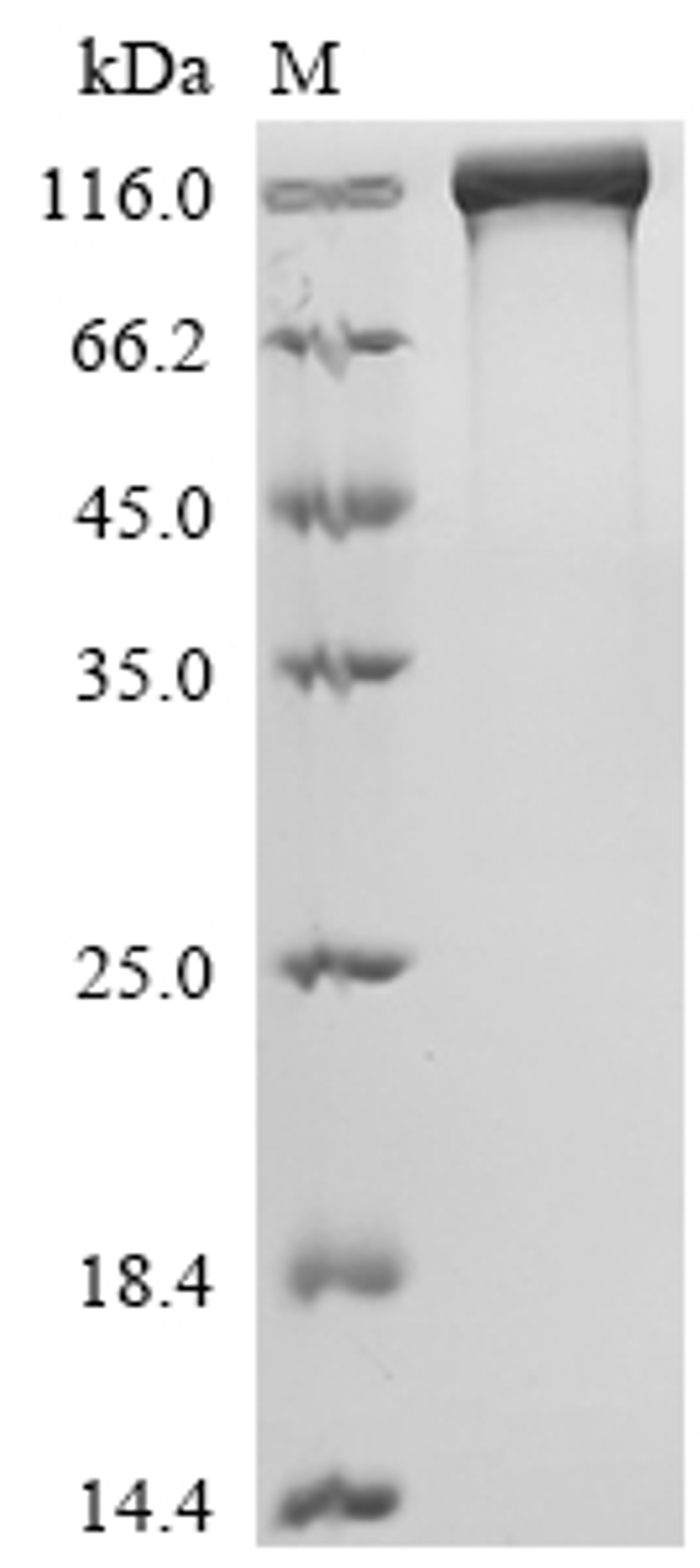 (Tris-Glycine gel) Discontinuous SDS-PAGE (reduced) with 5% enrichment gel and 15% separation gel.
