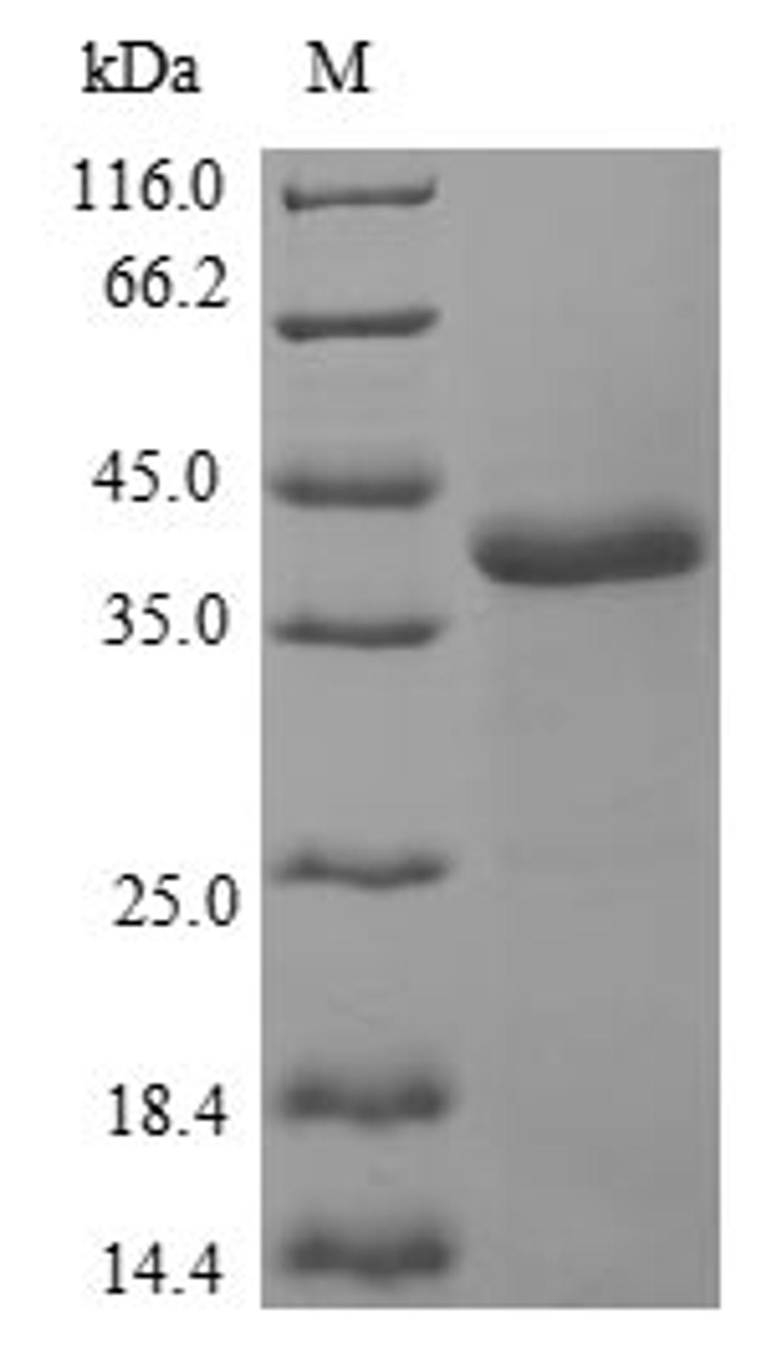 (Tris-Glycine gel) Discontinuous SDS-PAGE (reduced) with 5% enrichment gel and 15% separation gel.