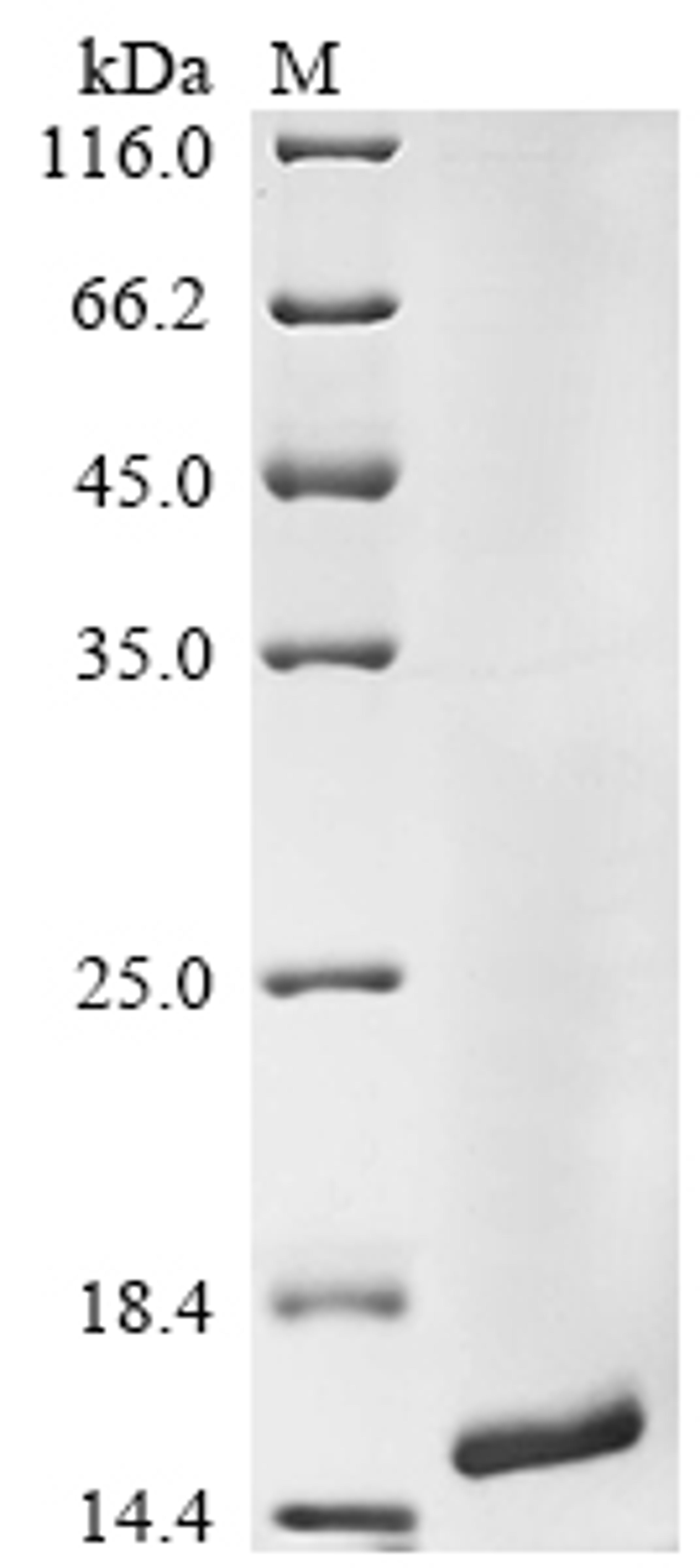 (Tris-Glycine gel) Discontinuous SDS-PAGE (reduced) with 5% enrichment gel and 15% separation gel.