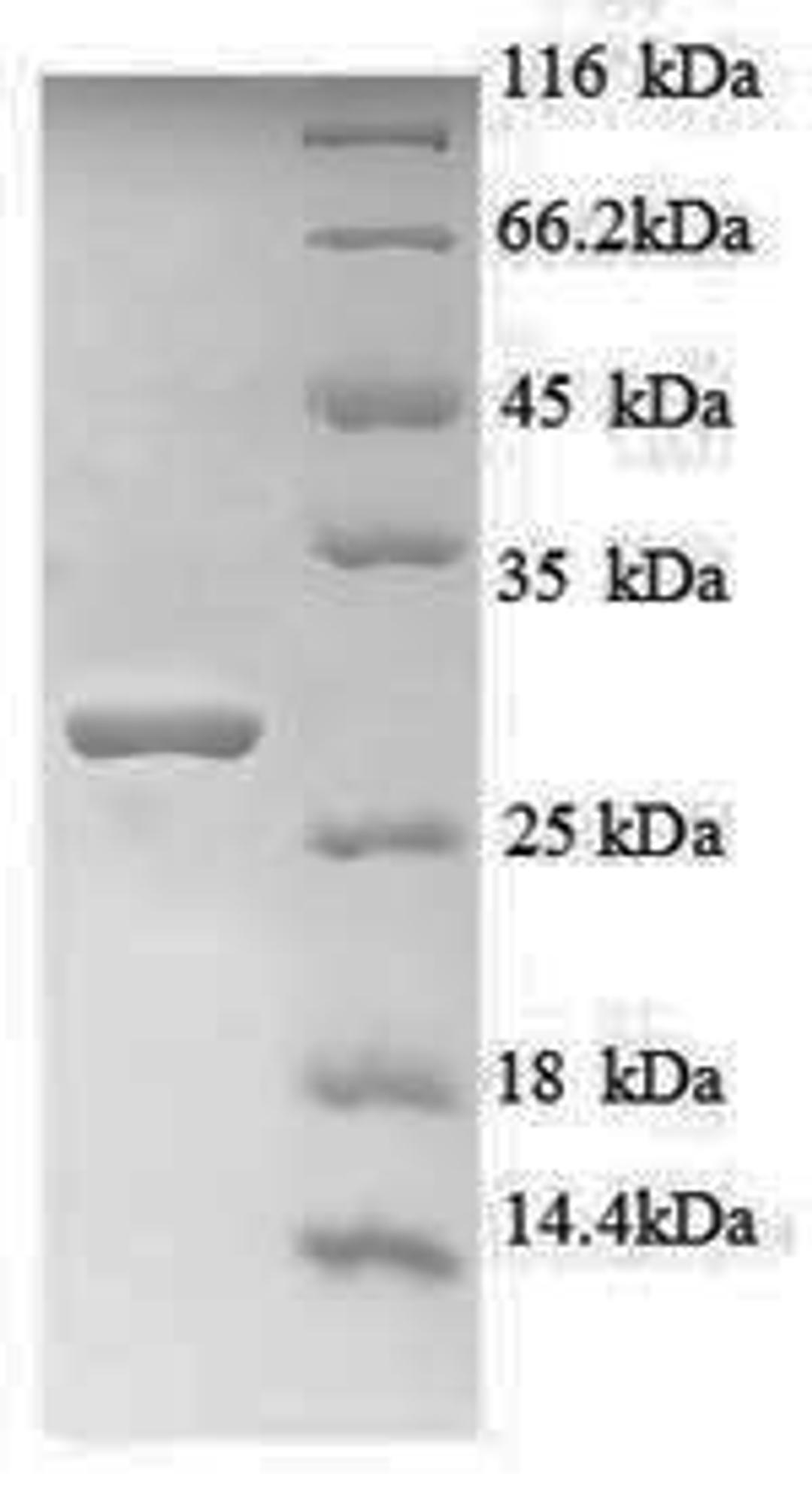(Tris-Glycine gel) Discontinuous SDS-PAGE (reduced) with 5% enrichment gel and 15% separation gel.