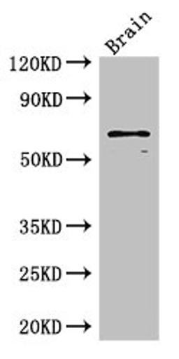 Western Blot. Positive WB detected in: Mouse brain tissue. All lanes: SLC6A3 antibody at 3ug/ml. Secondary. Goat polyclonal to rabbit IgG at 1/50000 dilution. Predicted band size: 69 kDa. Observed band size: 69 kDa. 