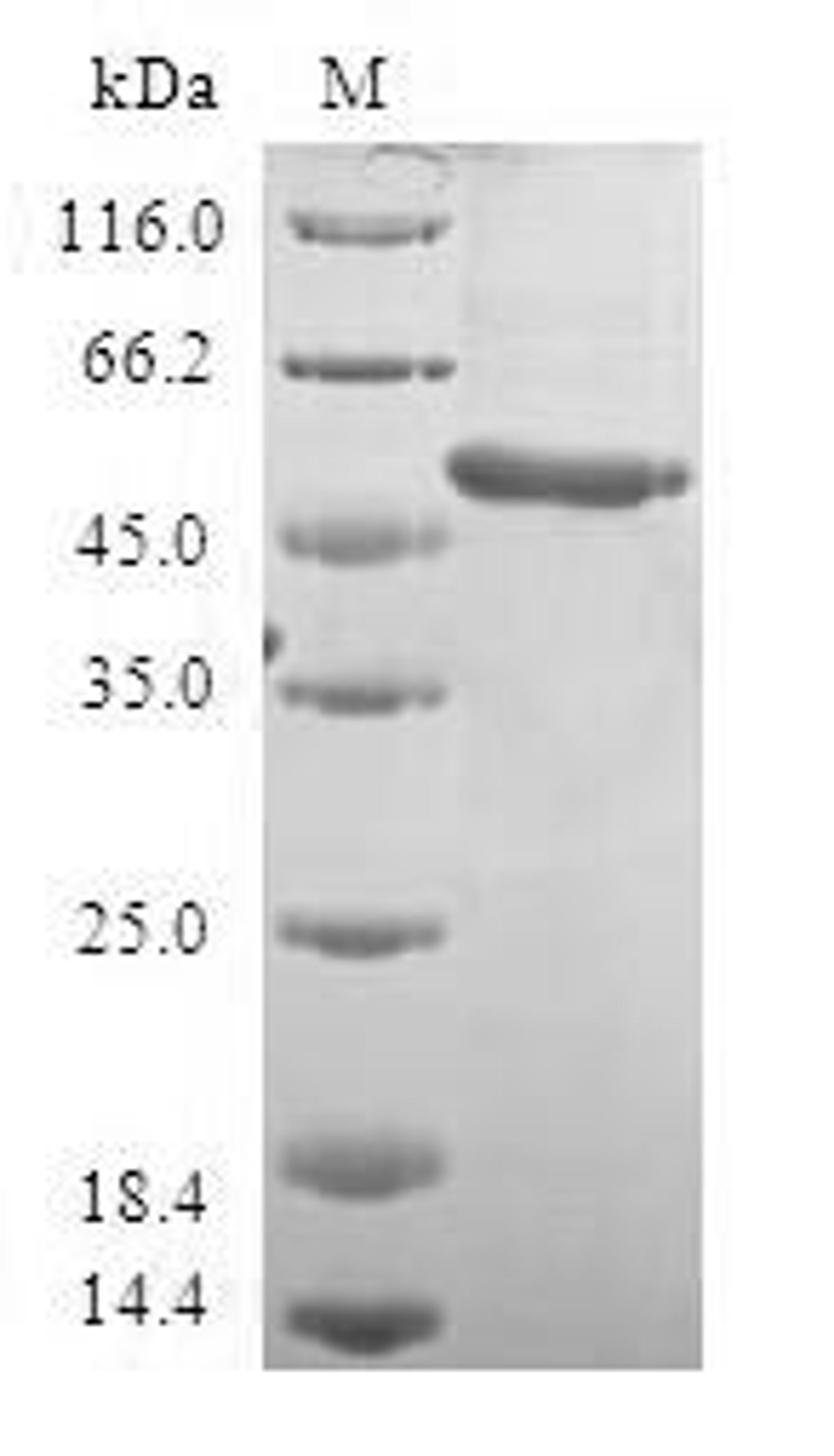 (Tris-Glycine gel) Discontinuous SDS-PAGE (reduced) with 5% enrichment gel and 15% separation gel.