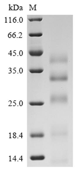 (Tris-Glycine gel) Discontinuous SDS-PAGE (reduced) with 5% enrichment gel and 15% separation gel.