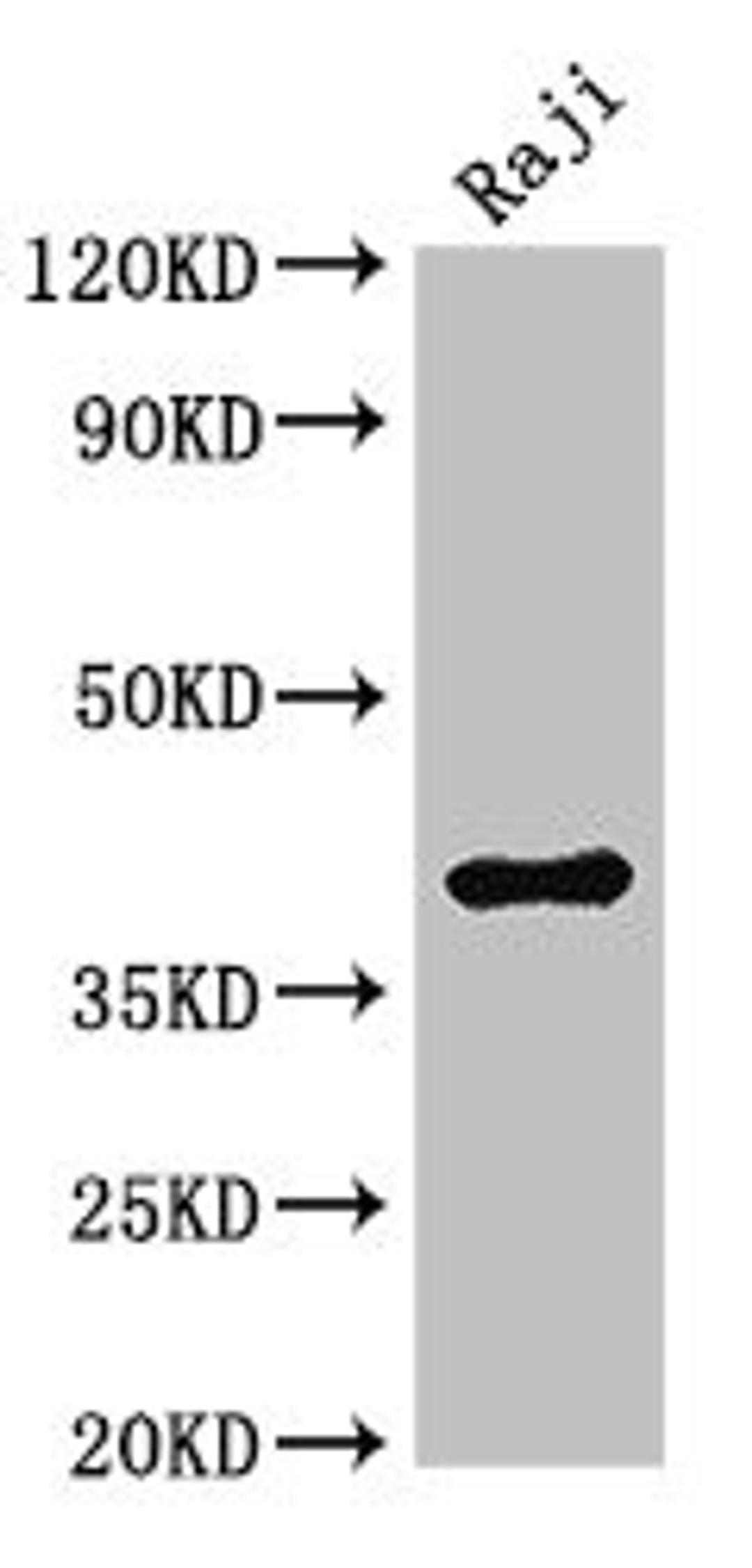 Western Blot. Positive WB detected in: Raji whole cell lysate. All lanes: HMBS antibody at 3µg/ml. Secondary. Goat polyclonal to rabbit IgG at 1/50000 dilution. Predicted band size: 40, 38, 35, 34 kDa. Observed band size: 40 kDa